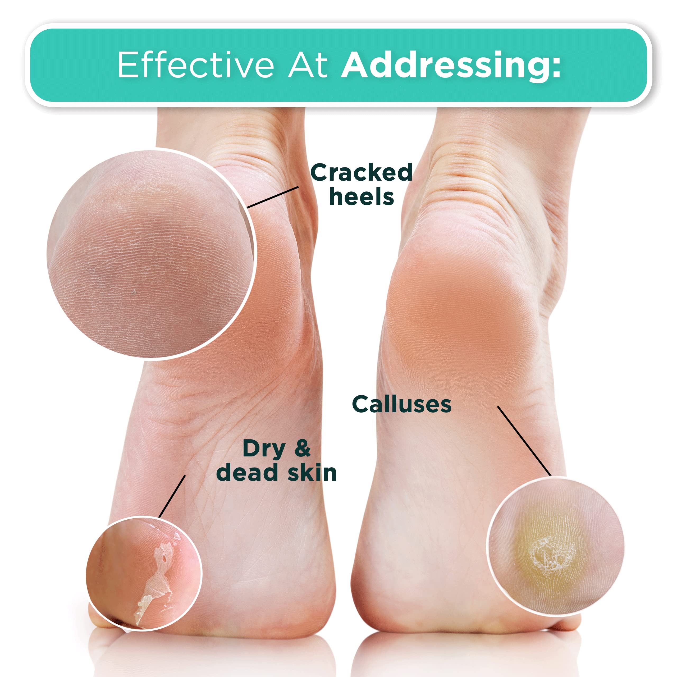 DERMORA Foot Peel Mask – Exfoliating Foot Masks for Dry, Cracked Feet & Callus Removal | Pack of 2 | Regular Size