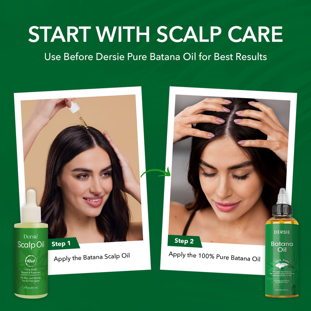 Dersie Scalp Oil for Hair Loss & Thinning Hair – Batana, Rosemary & Tea Tree (60mL)