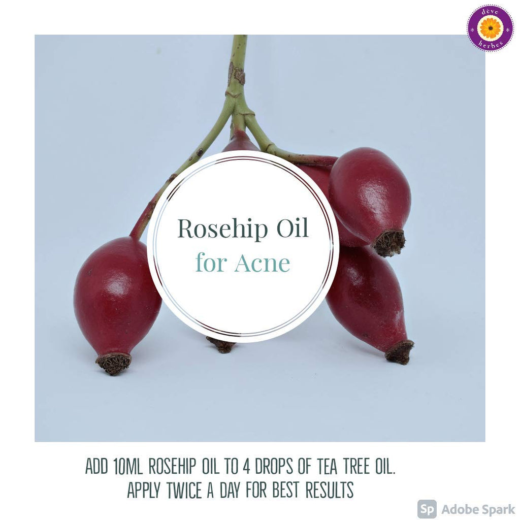 dève herbes Pure Rosehip Oil (Rosa rubiginosa) Cold-Pressed 30ml – All Skin Types