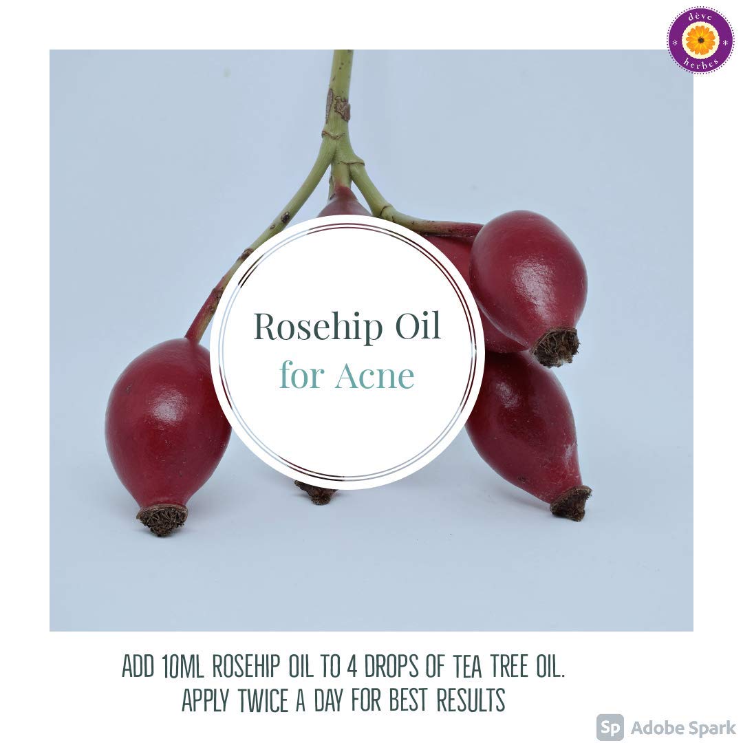 dève herbes Pure Rosehip Oil (Rosa rubiginosa) Cold-Pressed 30ml – All Skin Types