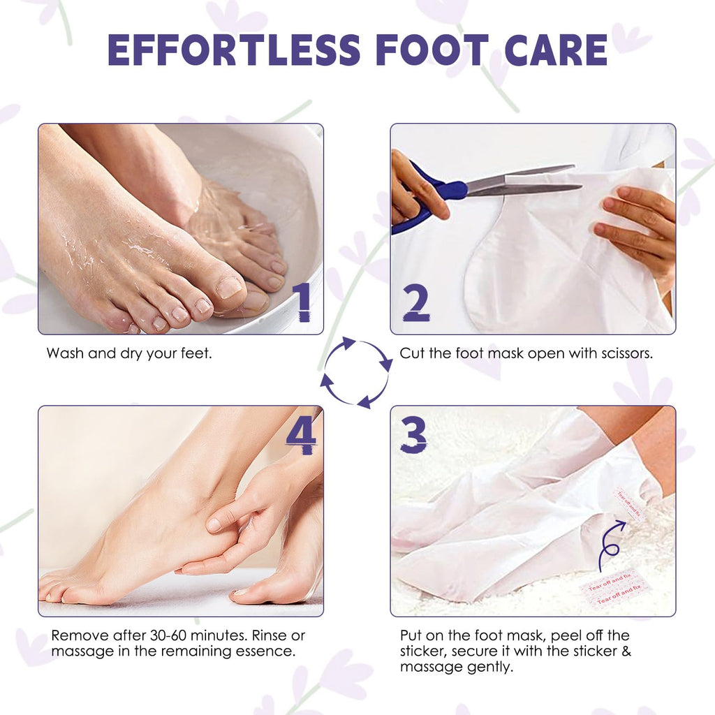 Devyonder Foot Peeling Mask 5 Pack – Exfoliate, Soften & Rejuvenate Dry Heels (Urea, Lavender & Salicylic Acid)