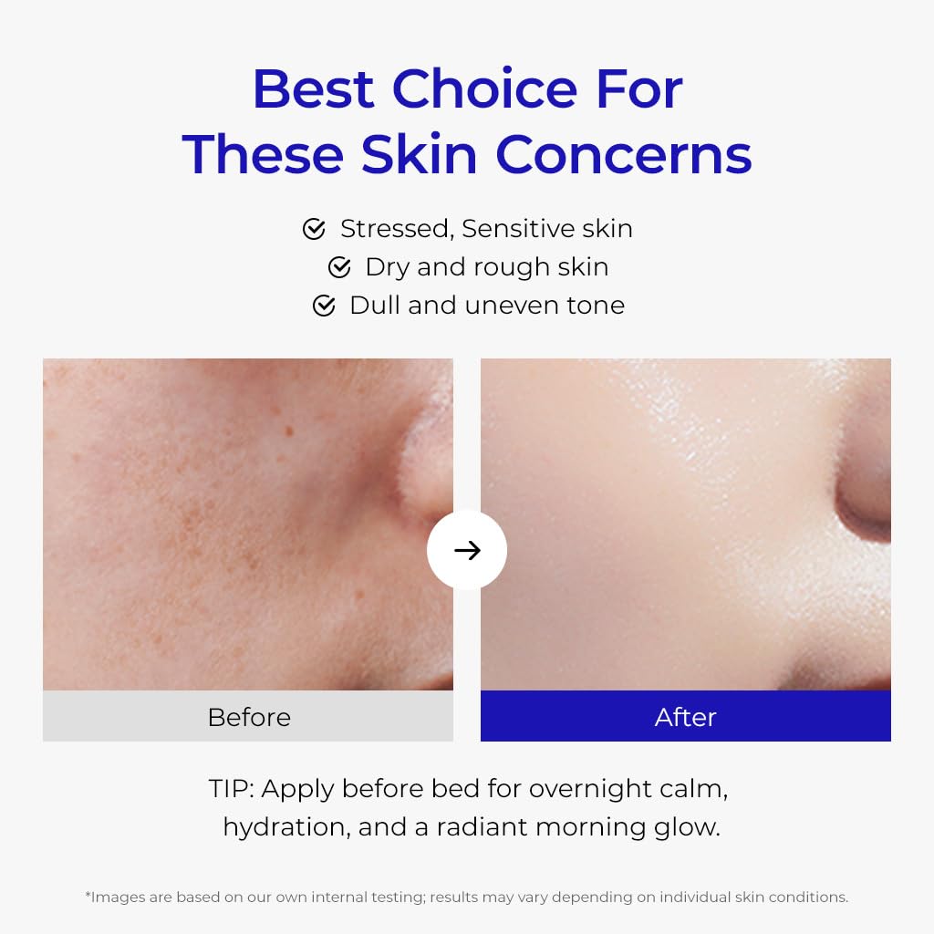 DEWYCEL Cica Plus Balm with Vitamin C Inducer — Premium Korean Day & Night Moisturizer | Centella Asiatica, Madecassoside, Hyaluronic Acid | 50 ml