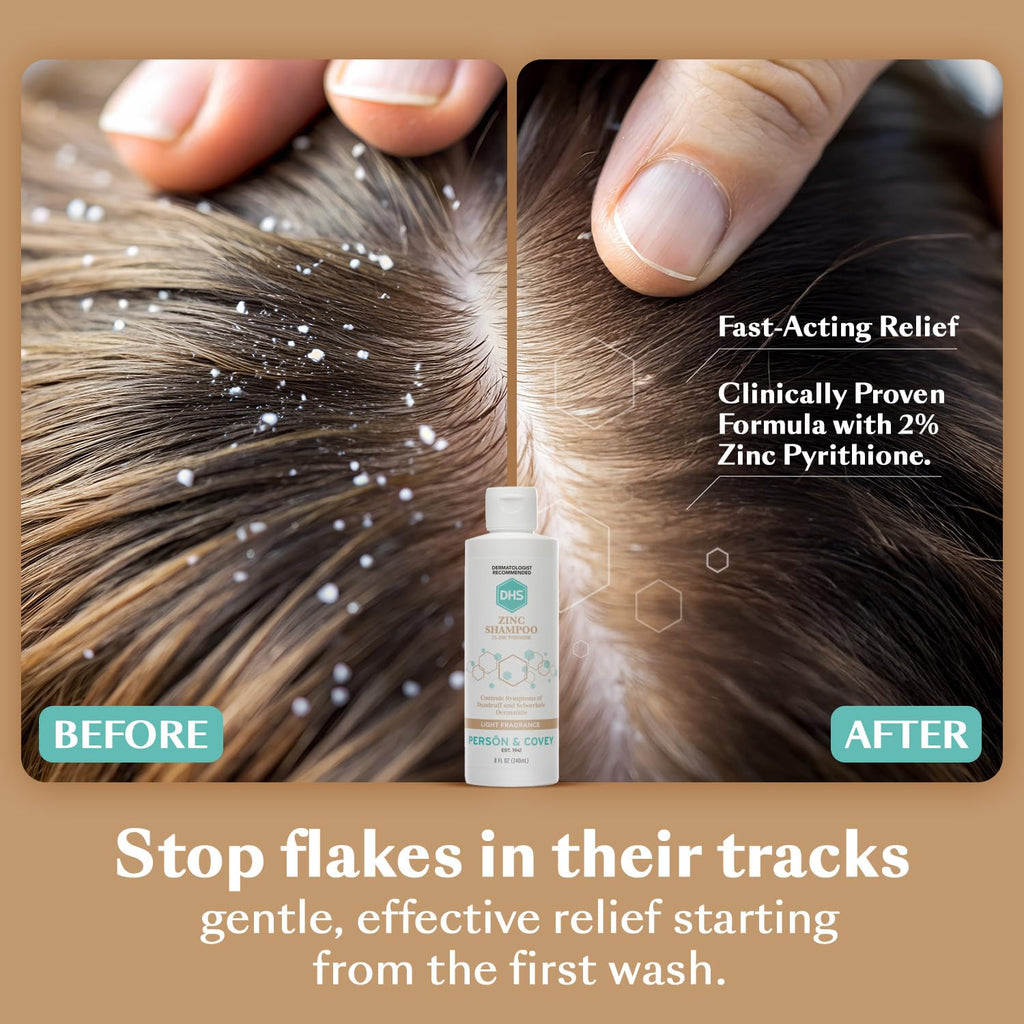 DHS Zinc Shampoo – Dandruff Relief with 2% Zinc Pyrithione | 8 oz