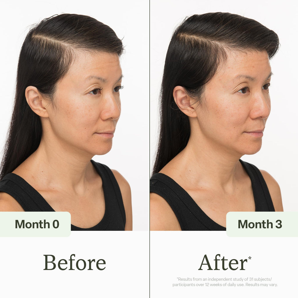 Divi Scalp Serum for Thinning Hair, 30ml — Clinically Tested, Nourishing Formula with Amino Acids, Caffeine & Rosemary Oil
