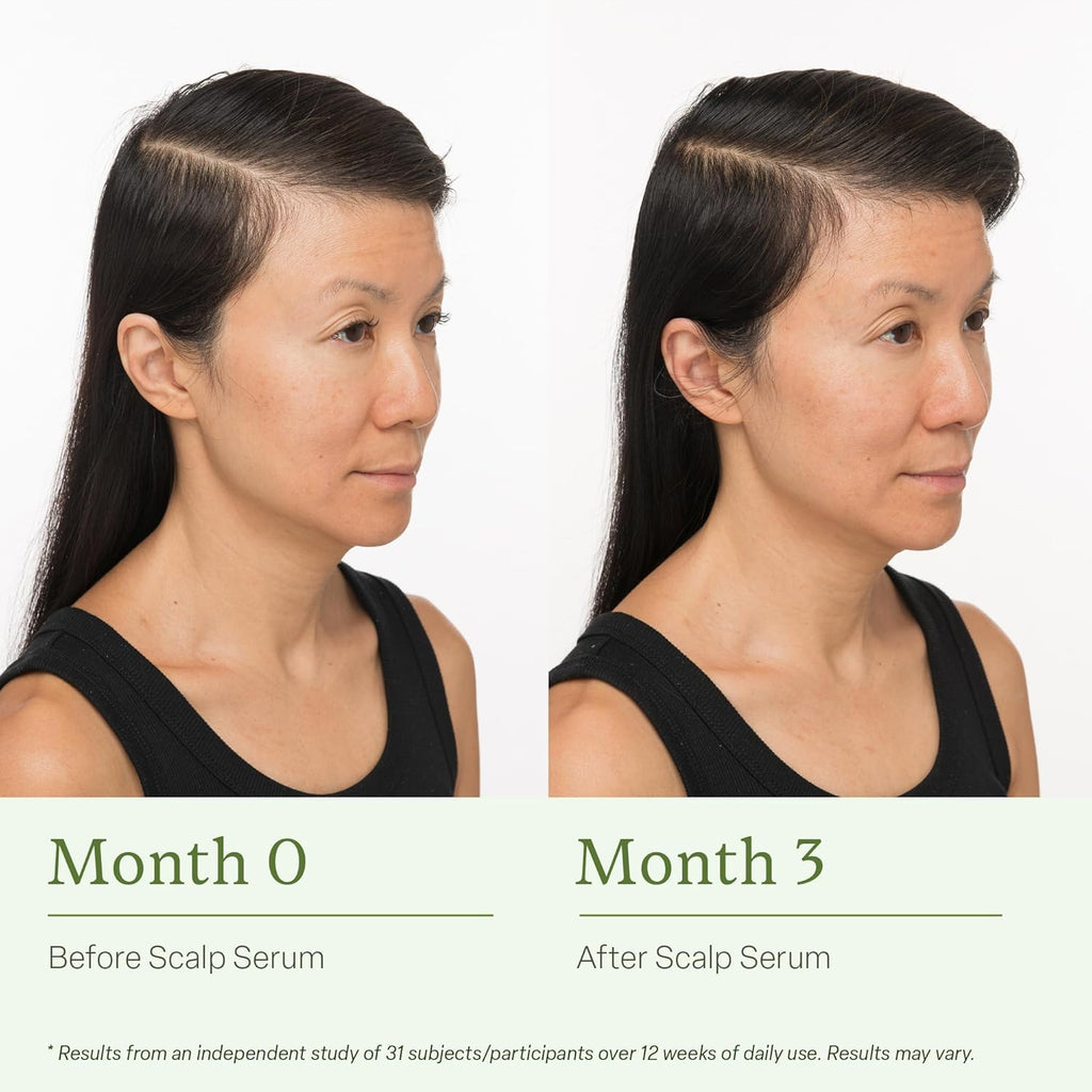 Divi Scalp Serum for Thinning Hair, 2-Pack, 30ml – Clinically Tested with Caffeine & Rosemary