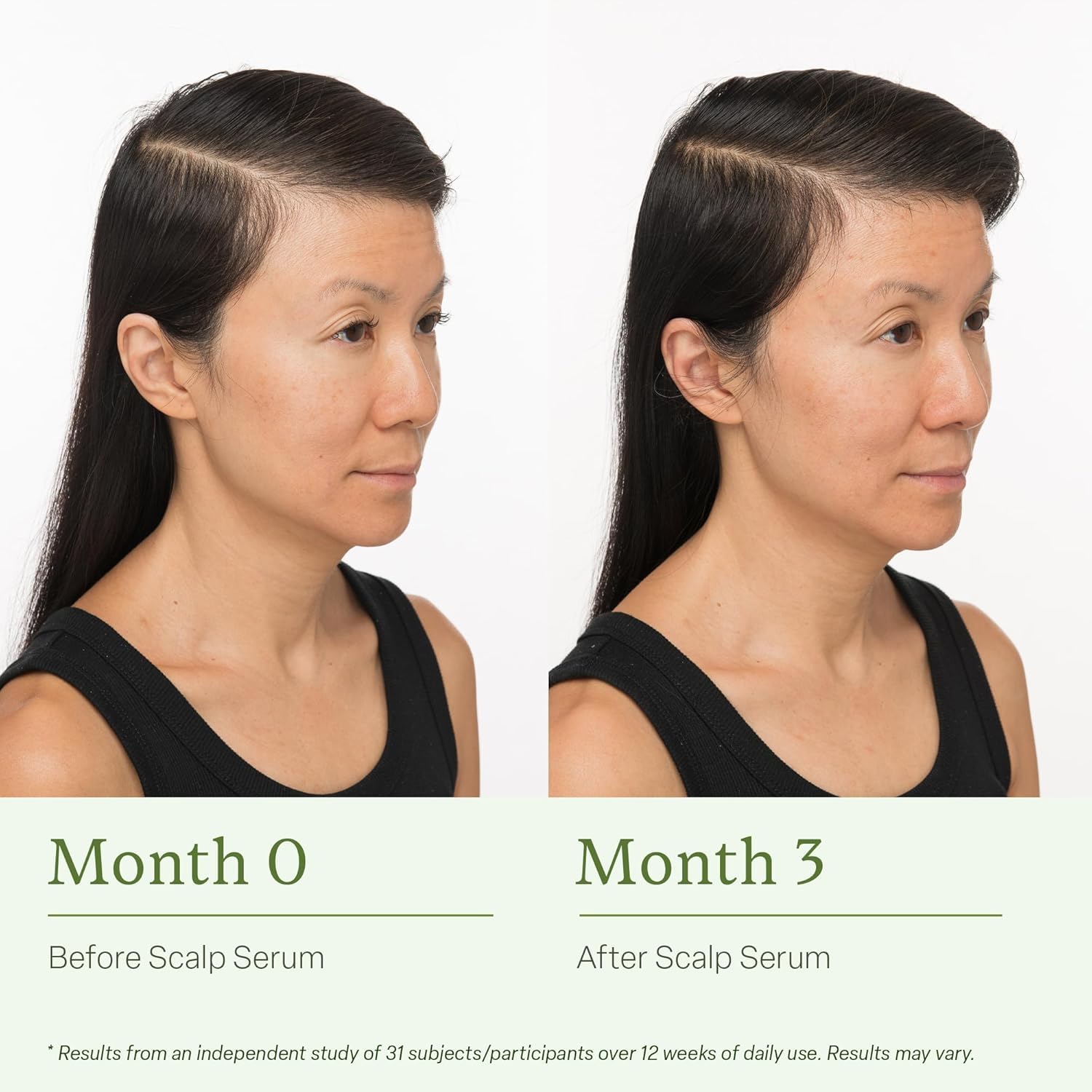 Divi Scalp Serum for Thinning Hair, 2-Pack, 30ml – Clinically Tested with Caffeine & Rosemary