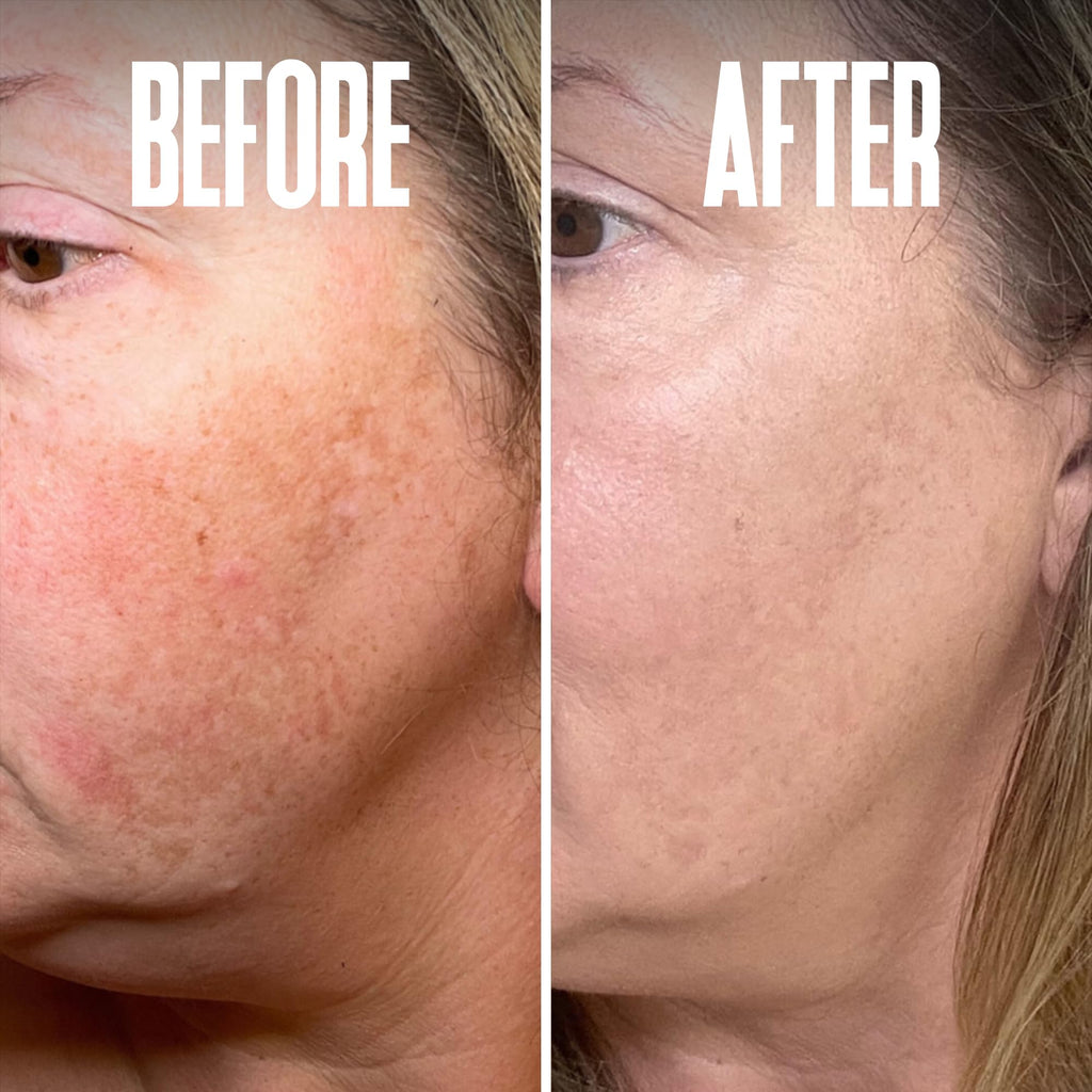 Divine Derriere Dark Spot Corrector Serum – Kojic Acid, Alpha Arbutin & Mulberry