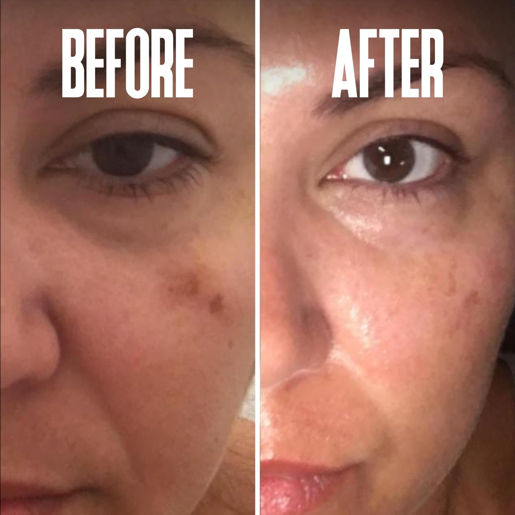 Divine Derriere Dark Spot Corrector Serum – Kojic Acid, Alpha Arbutin & Mulberry