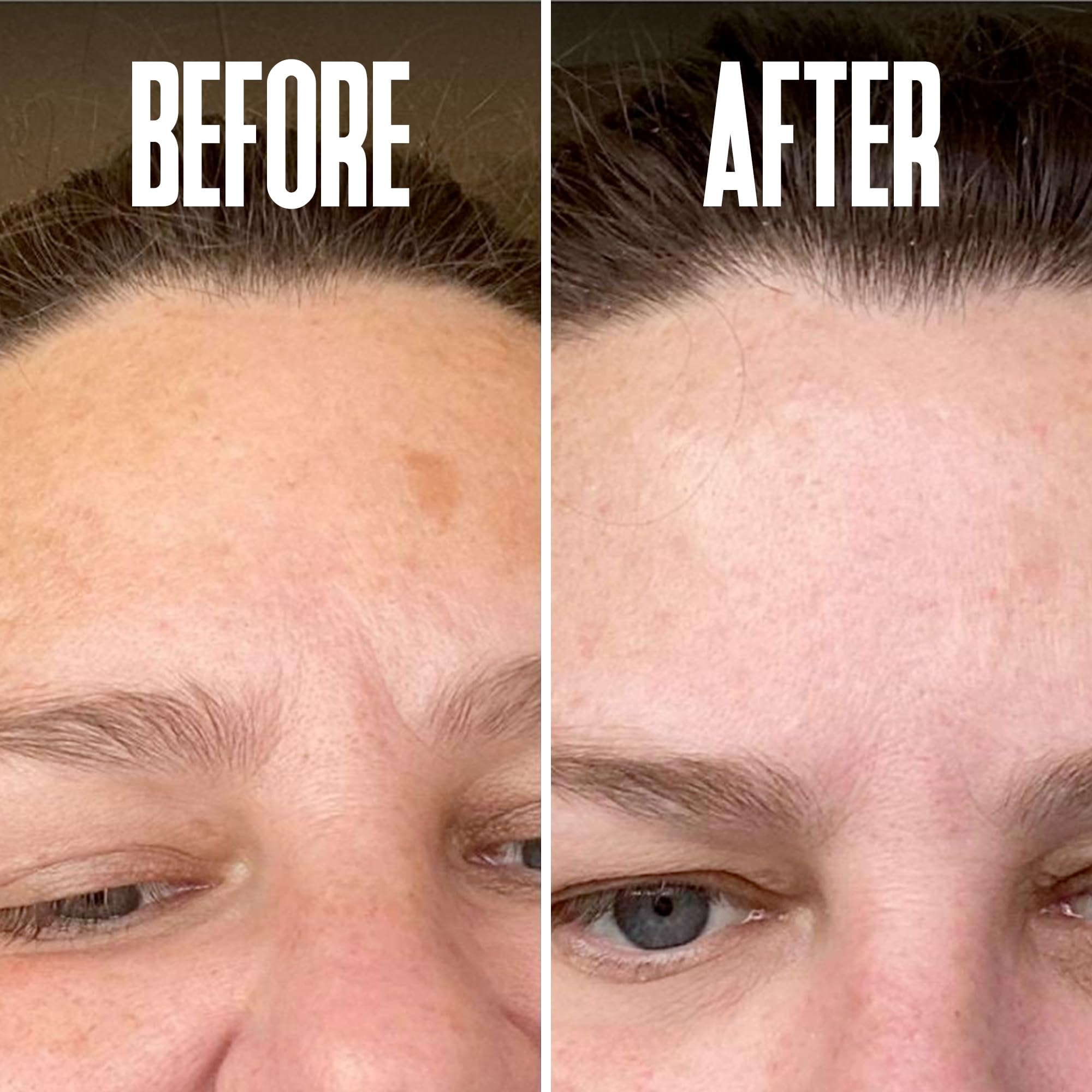 Divine Derriere Dark Spot Corrector Serum – Kojic Acid, Alpha Arbutin & Mulberry