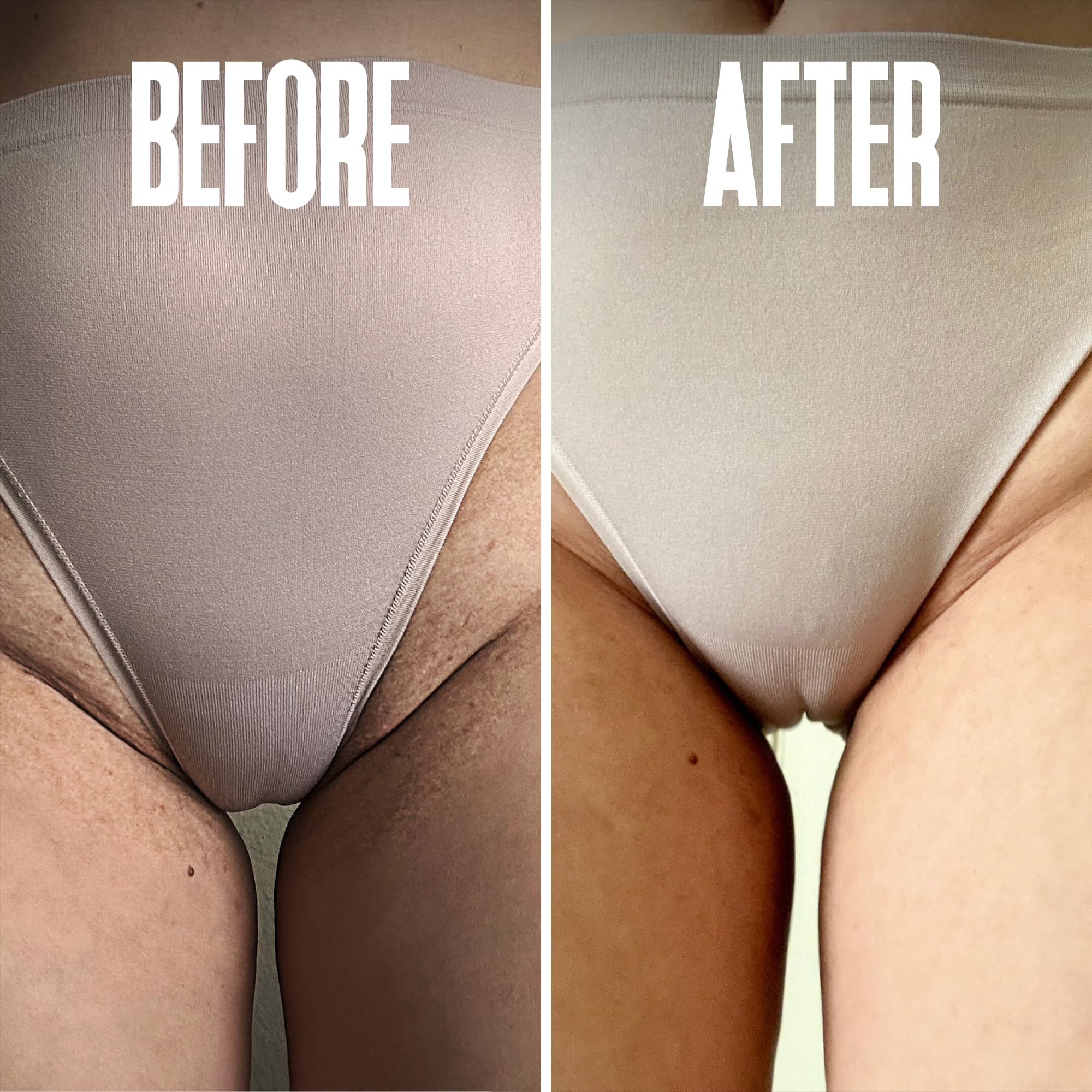 Divine Derriere Ingrown Hair Pads – Smoothing Solution for Razor Burns (50ct)