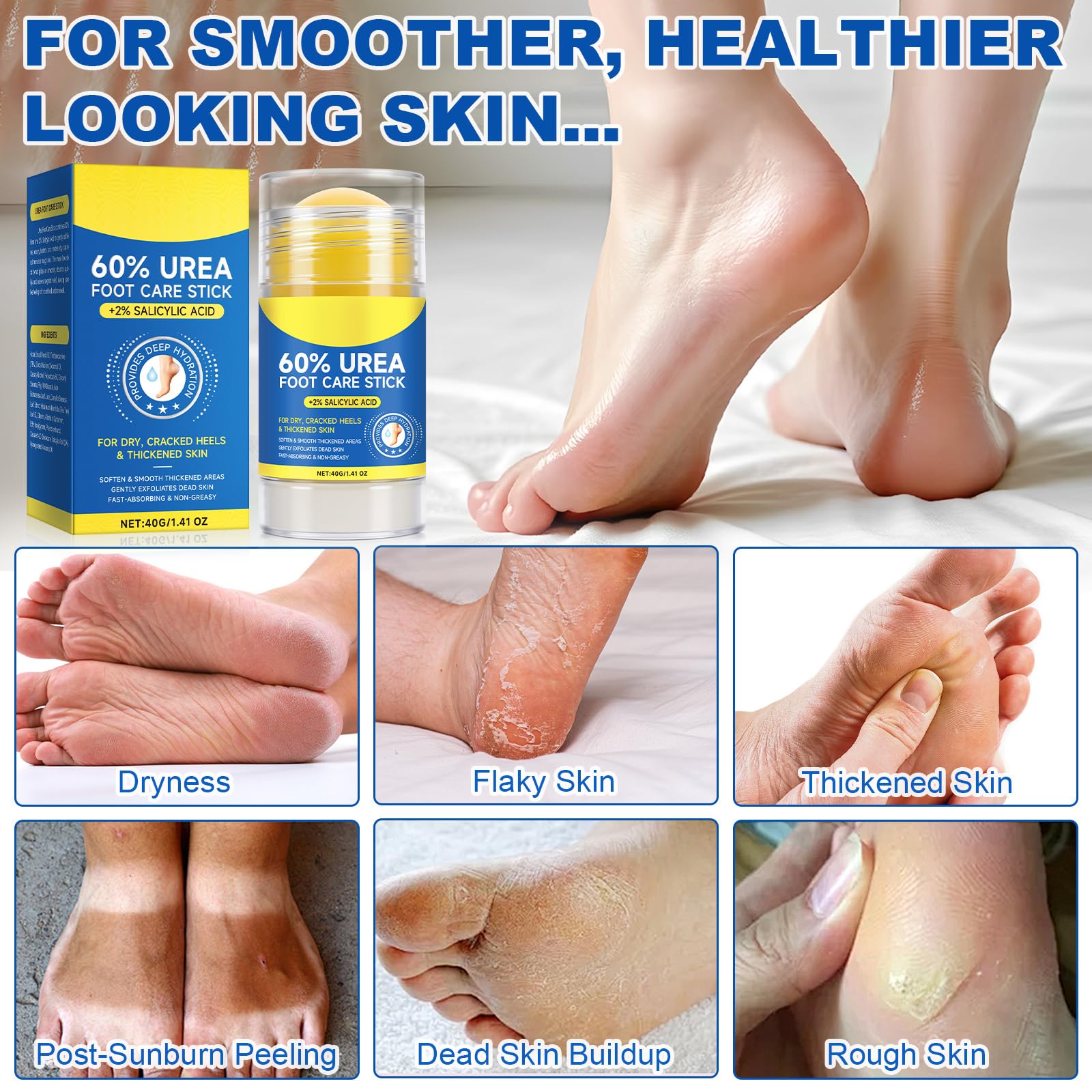 DLOMFVFQ 60% Urea + 2% Salicylic Acid Foot Care Stick – 2-Pack for Cracked Feet, Knees & Elbows