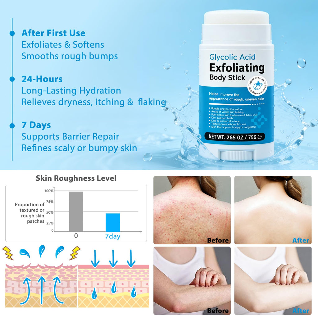 DNQYWODQ 7% Glycolic Acid Exfoliating Body Stick – Smooth Elbows, Knees & Bikini Line