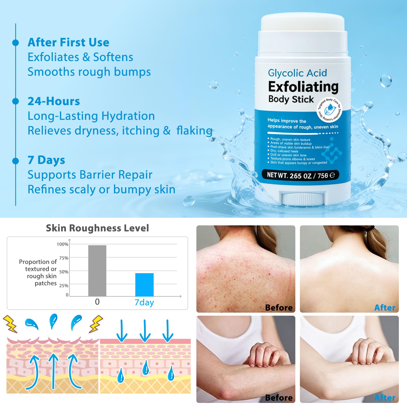 DNQYWODQ 7% Glycolic Acid Exfoliating Body Stick – Smooth Elbows, Knees & Bikini Line