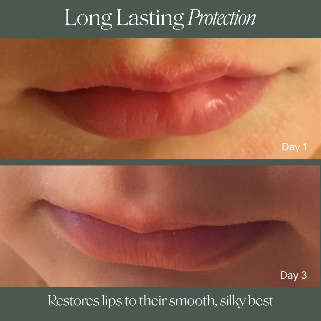 Doctor Rogers Lip Balm — Hydrating & Softening Lip Moisturizer, 0.15 oz (4.25 g) Pack of 3