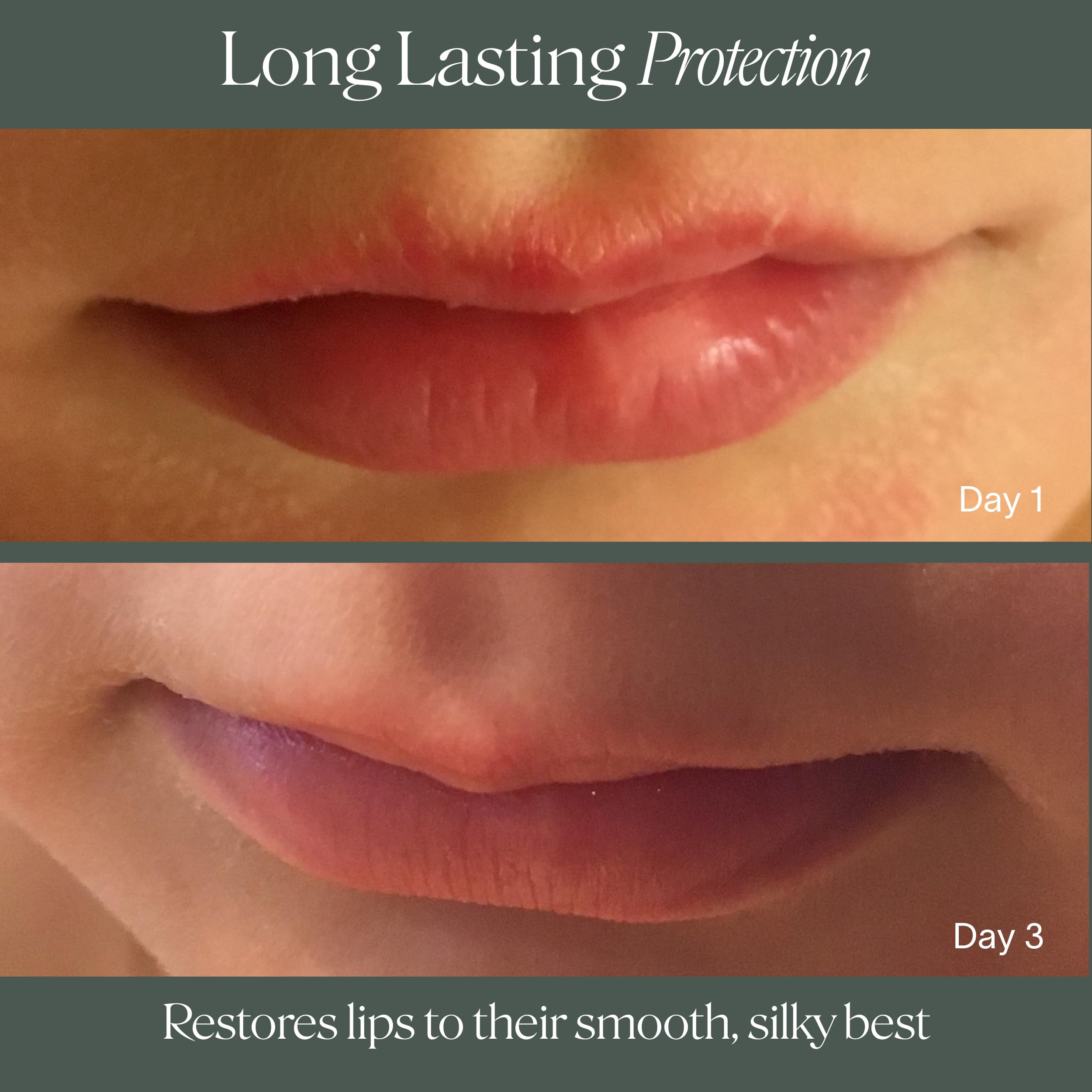 Doctor Rogers Lip Balm — Hydrating & Softening Lip Moisturizer, 0.15 oz (4.25 g) Pack of 3
