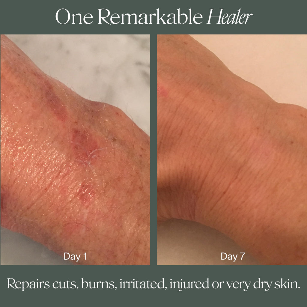 Doctor Rogers Restore Healing Balm — Multi-Purpose Ointment for Dry Skin, Eczema & Sensitive Skin (4 oz)