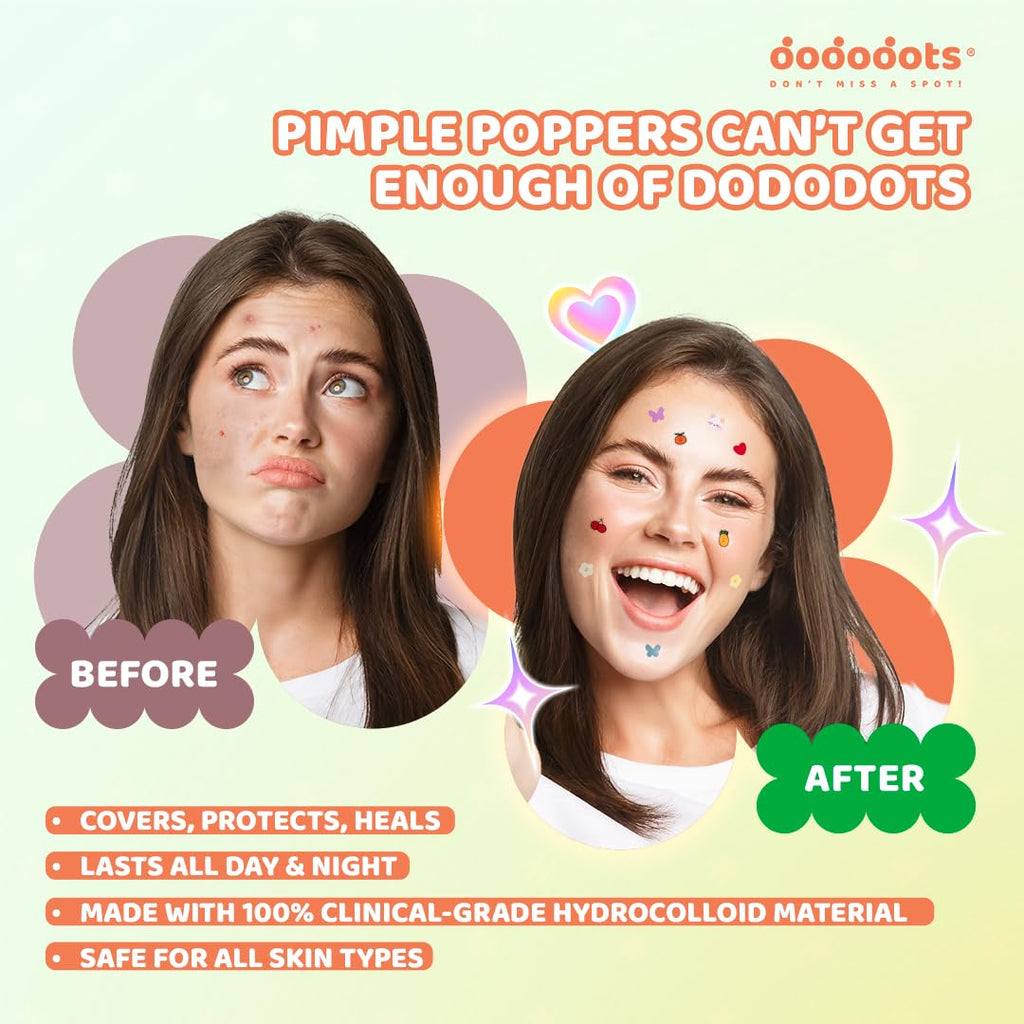 Dododots Pimple Patches for Face – Butterfly, Cloud & Heart Hydrocolloid Acne Patches