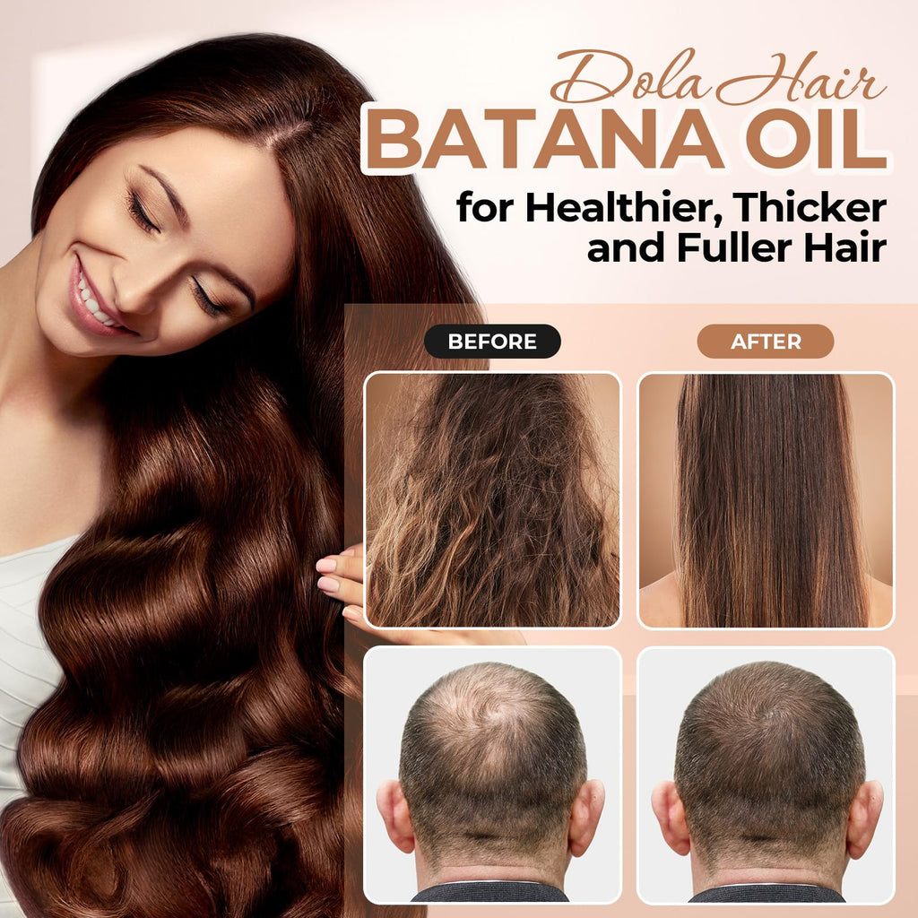 Dolahair Batana Oil for Hair Growth – 100% Pure Batana Oil