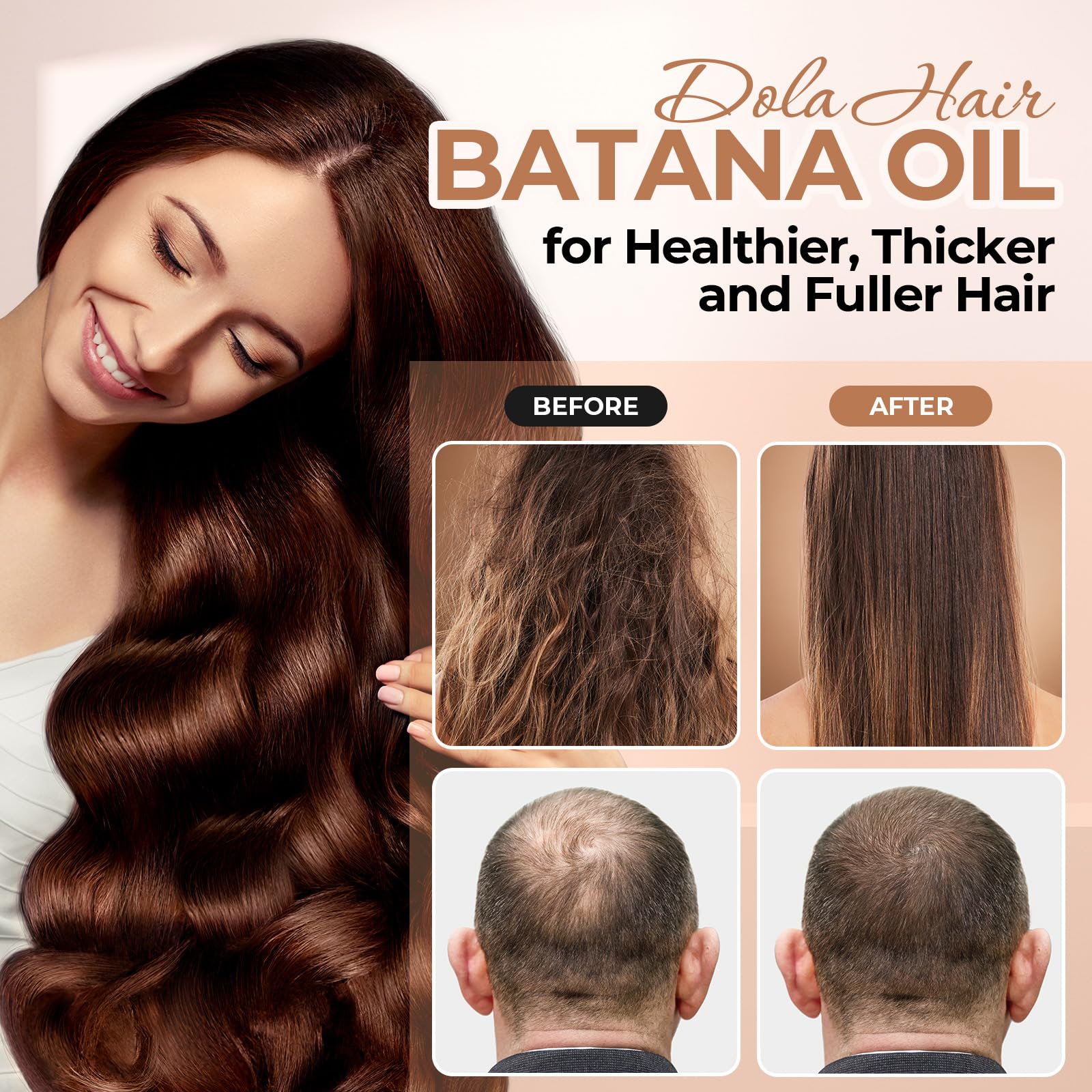 Dolahair Batana Oil for Hair Growth – 100% Pure Batana Oil