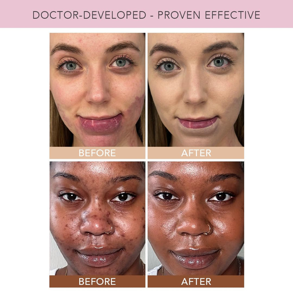 Doll 10 NO TCE Liquid Filter CC Cream – Light Skin Tint, Vegan, Clean Makeup