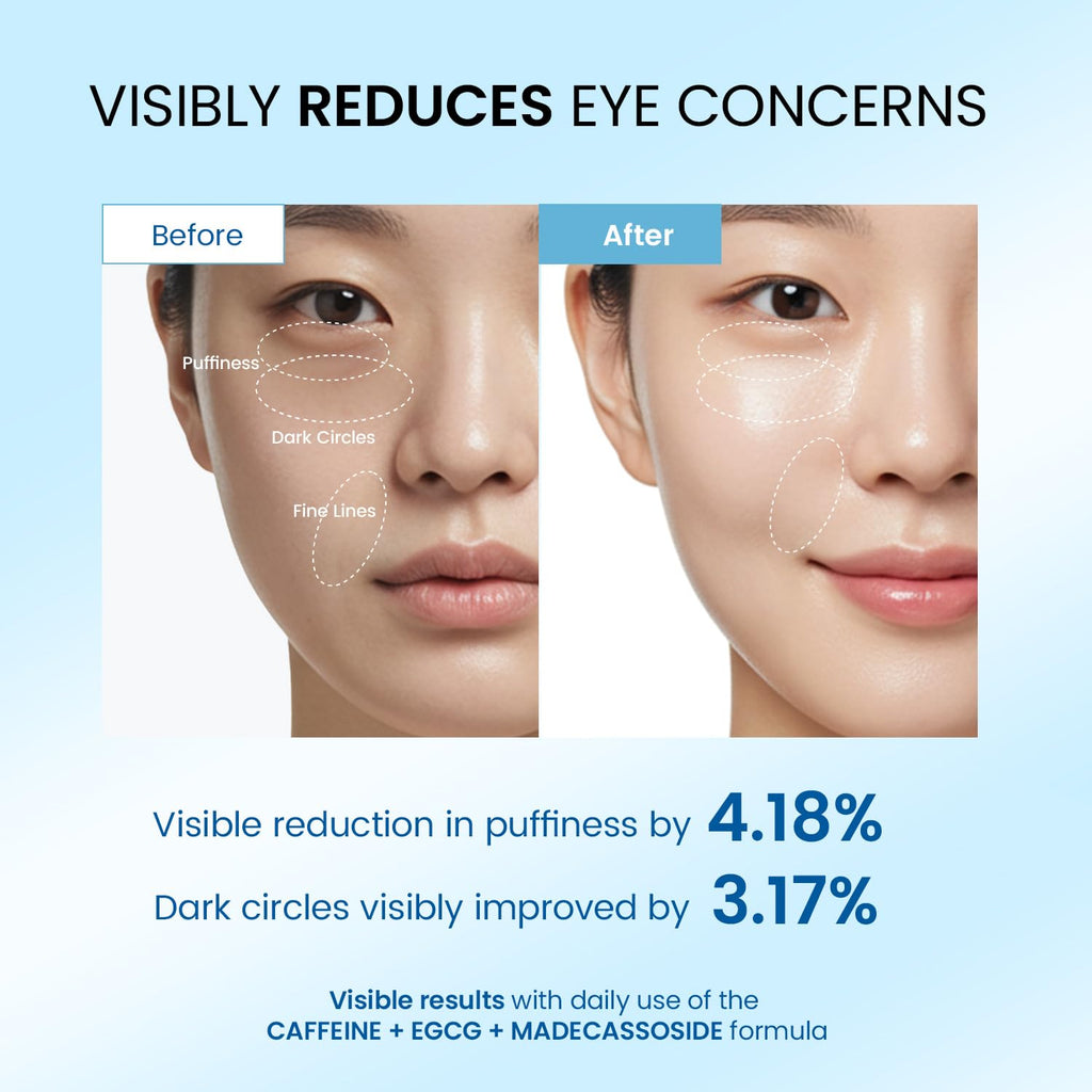 Dongyu Eye Cream for Dark Circles — Korean Caffeine Eye Serum for Morning Radiance (Blue)