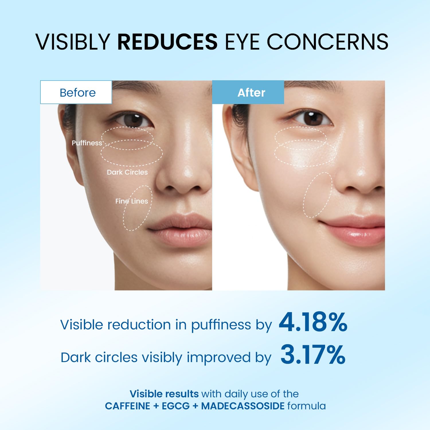 Dongyu Eye Cream for Dark Circles — Korean Caffeine Eye Serum for Morning Radiance (Blue)
