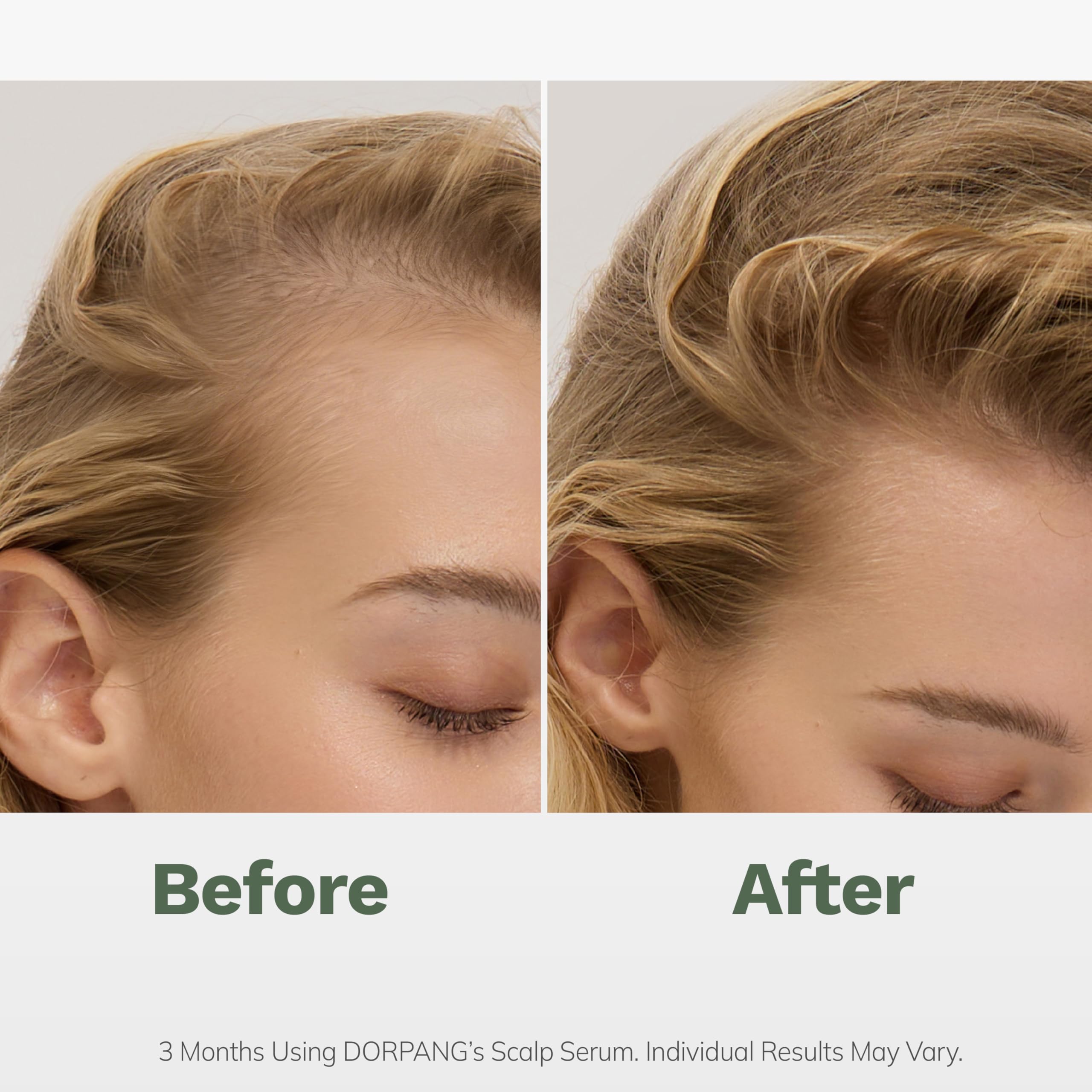 DORPANG Scalp Serum for Thinning Hair – Vegan Peptides, Non-Greasy, 60ml, No-Rinse