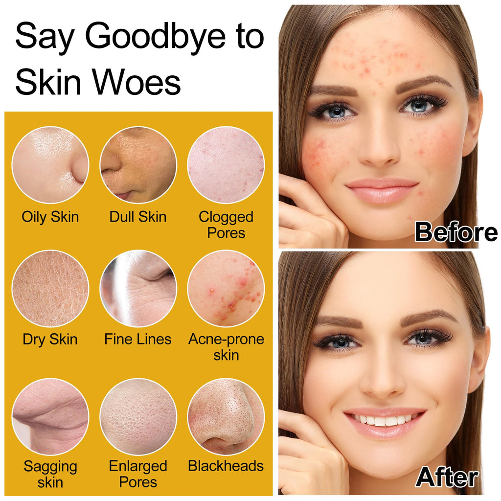 DOYEEWO Skin Care Set – 5Pcs with Korean Rice Extract for Hydration, Glow & Anti-Aging