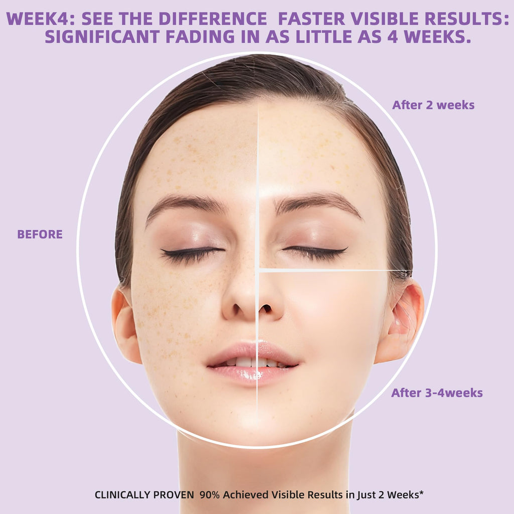 DQOJVU Dark Spot Remover for Face & Body – Even Tone, Sun & Age Spot Correction
