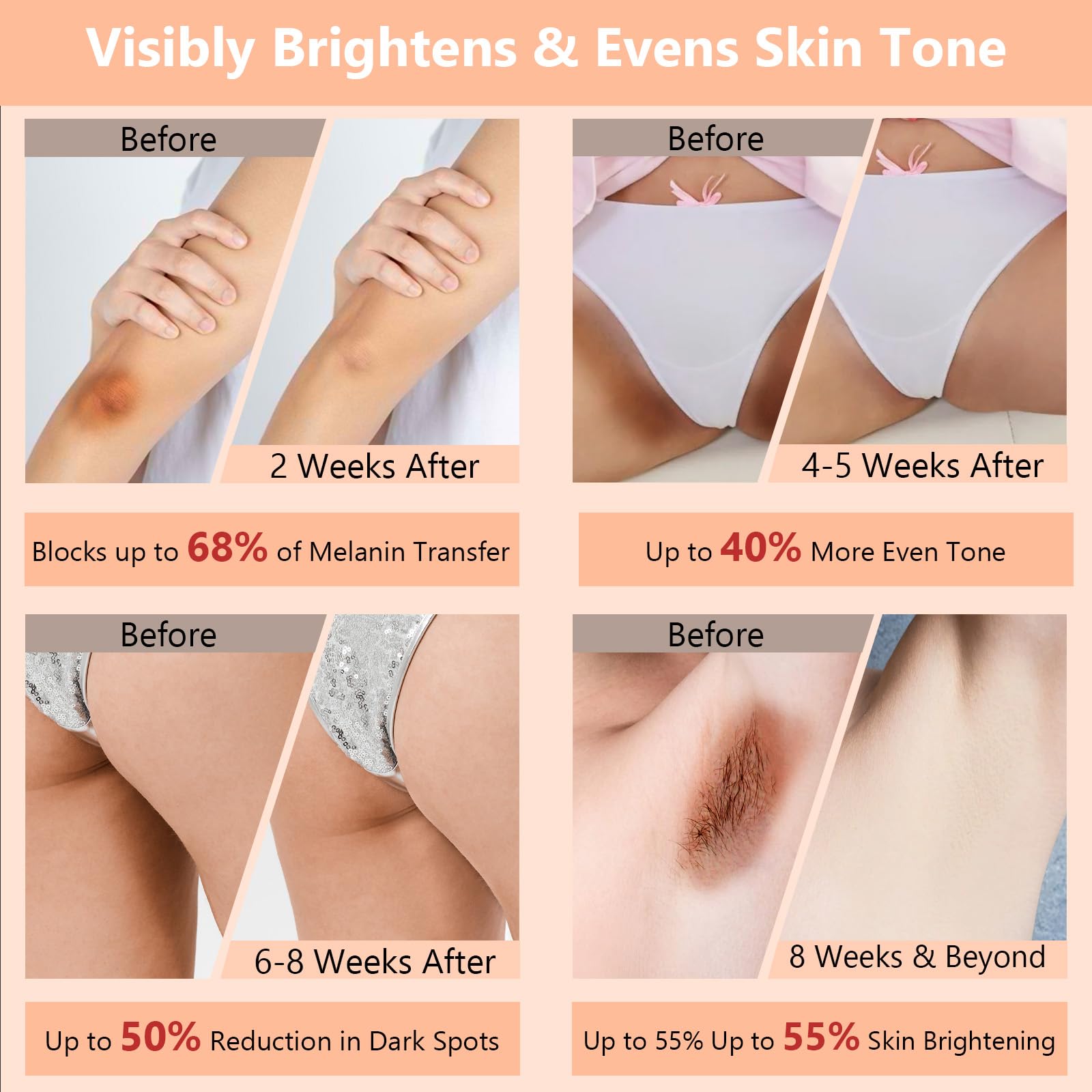 DR.Afanyr 100ml Skin Bleaching Cream – Brighten Dark Spots & Even Tone for All Skin Types