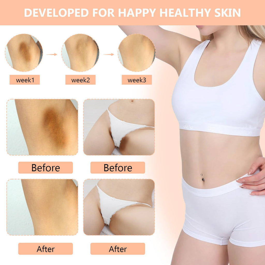 DR.Afanyr Skin Bleaching Cream – Brighten Dark Spots & Uneven Tone (All Skin Types)