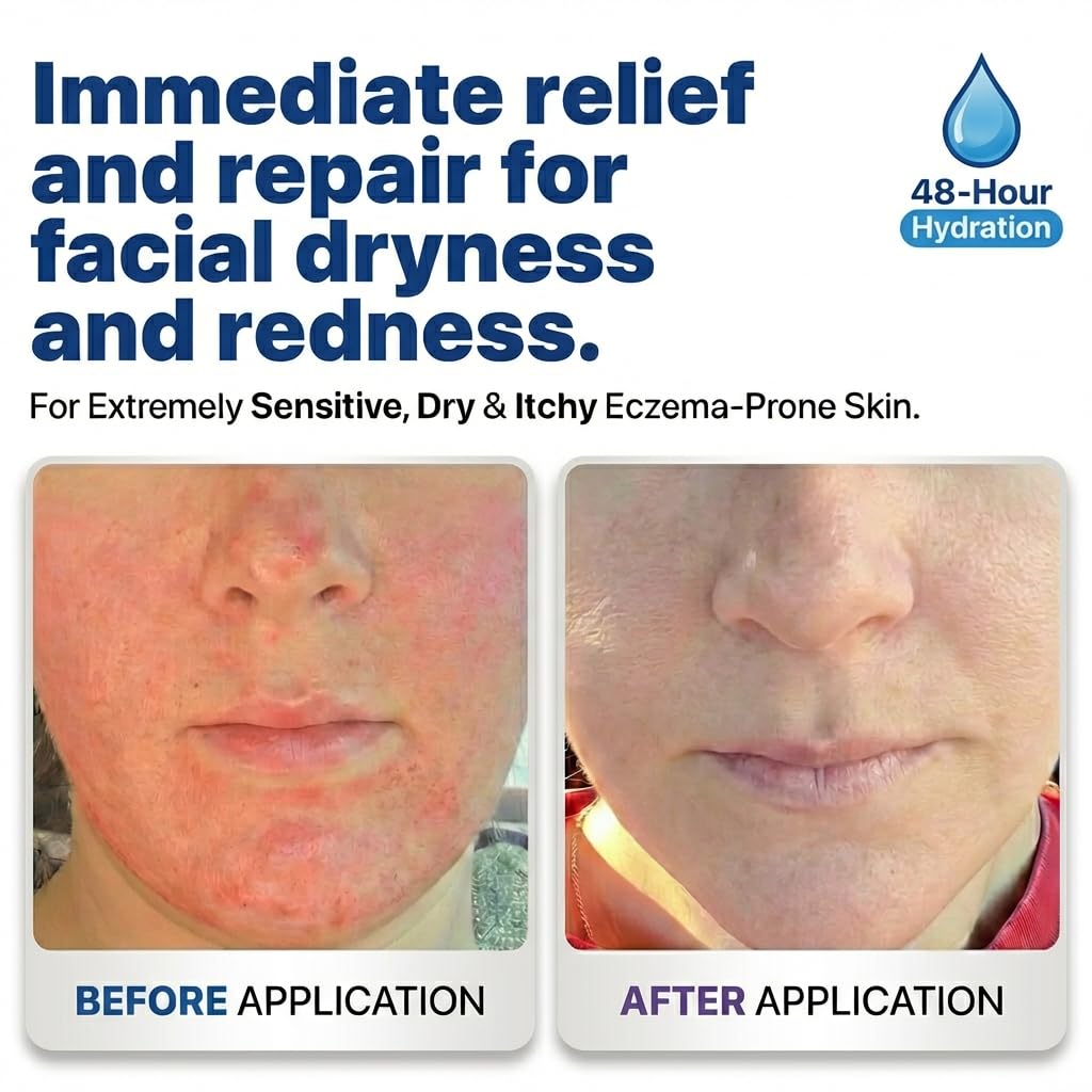 Dr. Arsy Eczema Cream for Adults & Kids – Hypoallergenic Barrier Repair Moisturizer, Fragrance-Free, USA Made