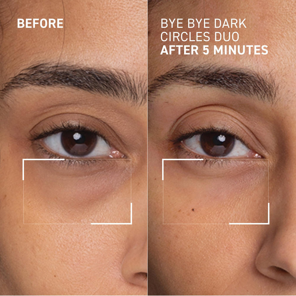 Dr. Brandt Bye Bye Dark Circles Duo: No More Baggage & Bright This Way Retinol Eye Cream