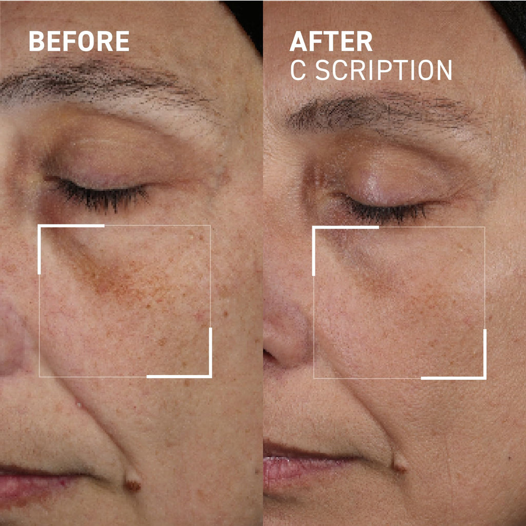 Dr. Brandt Bright This Way C Scription Vitamin C Serum – Fade Dark Spots & Illuminate Skin Tone (2 x 1 fl oz)
