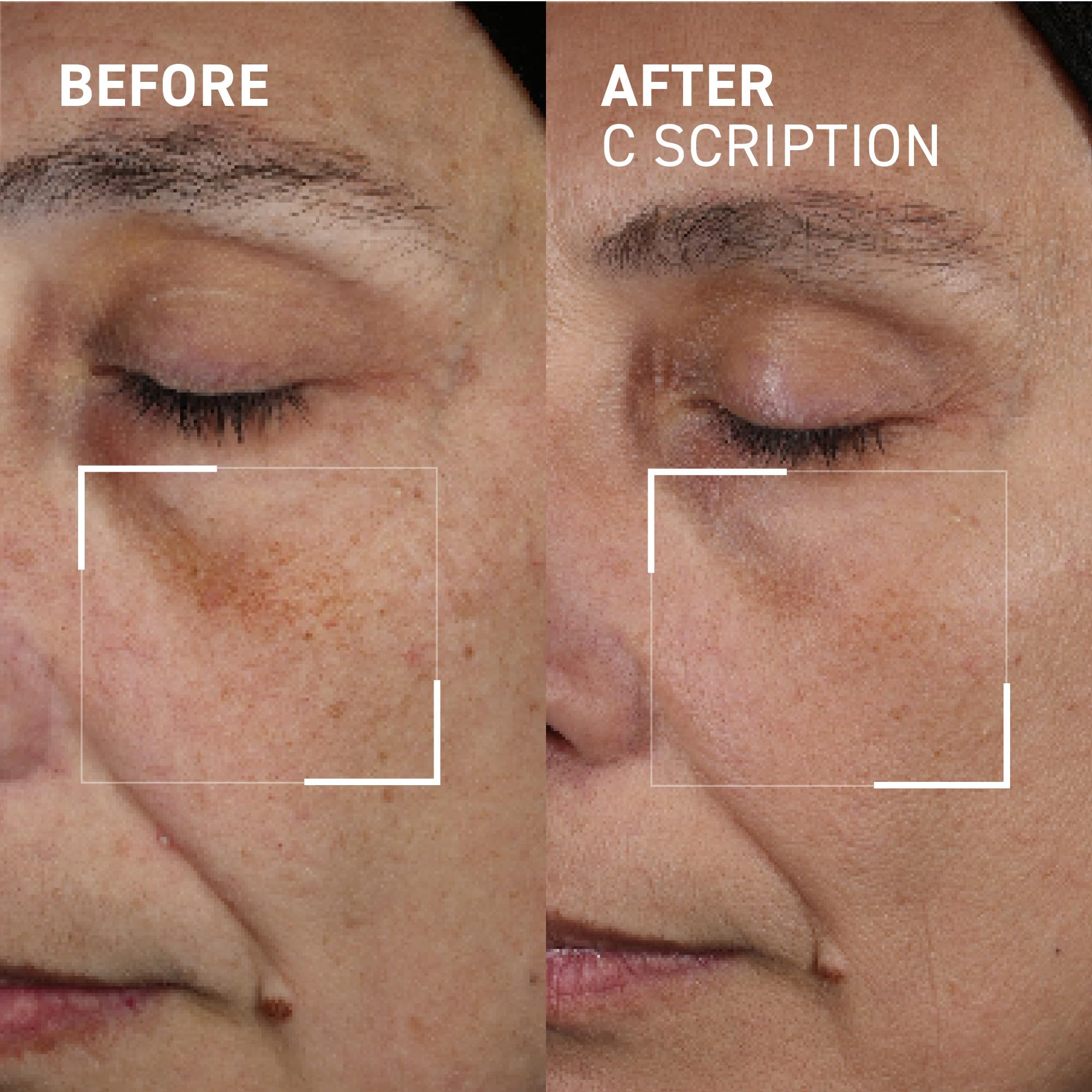 Dr. Brandt Bright This Way C Scription Vitamin C Serum – Fade Dark Spots & Illuminate Skin Tone (2 x 1 fl oz)