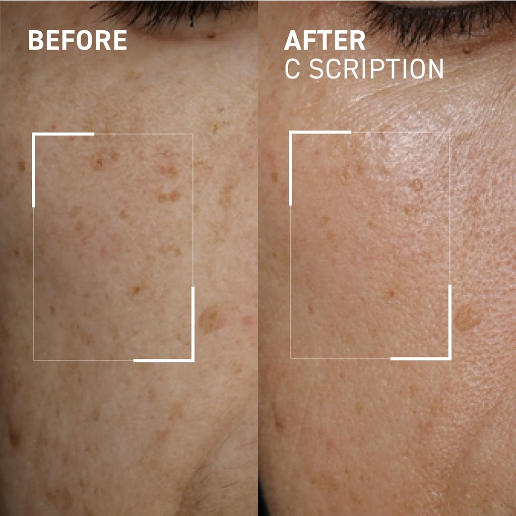 Dr. Brandt Bright This Way C Scription Vitamin C Serum – Fade Dark Spots & Illuminate Skin Tone (2 x 1 fl oz)