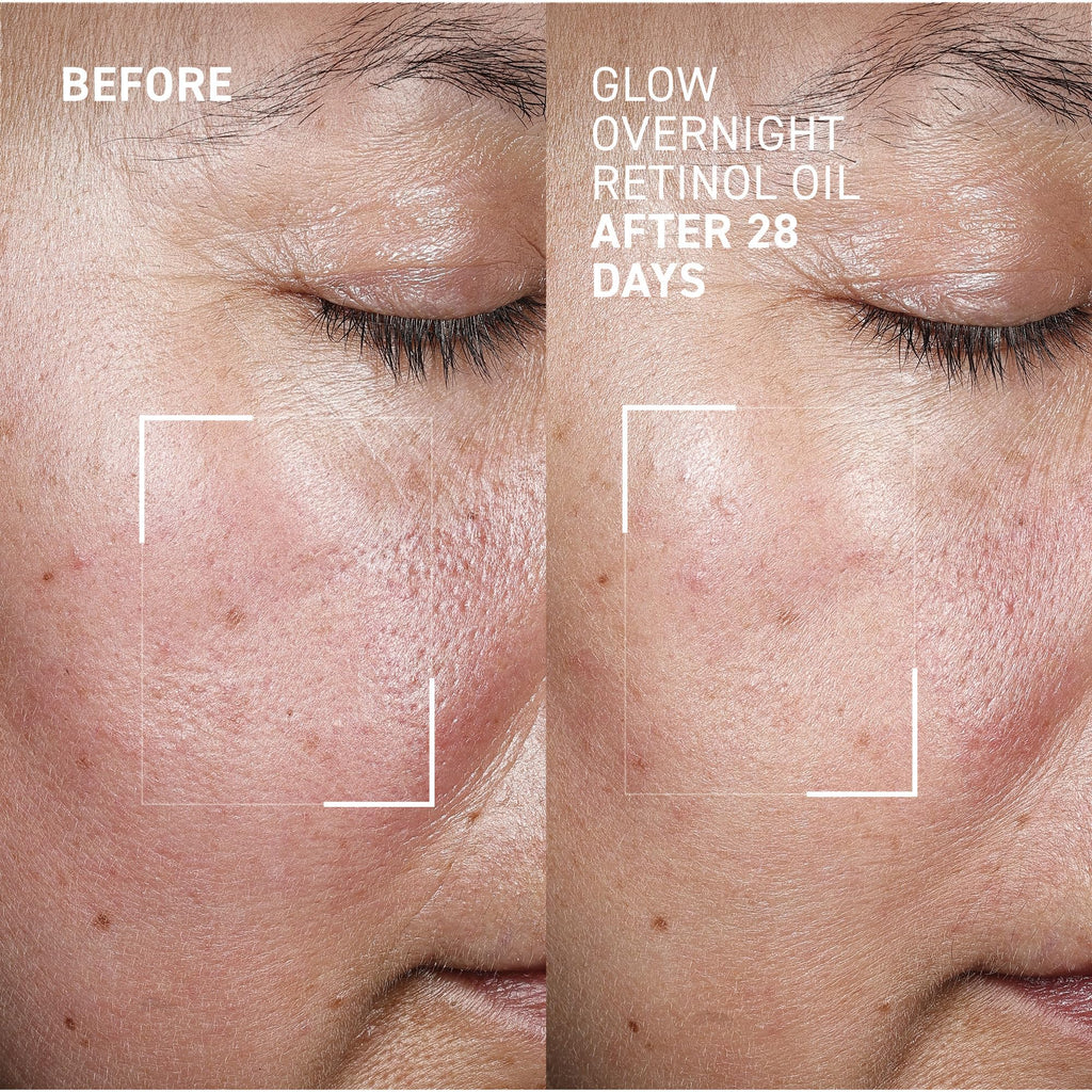 Dr. Brandt Bright This Way Glow Overnight Retinol Oil – 2 x 1 fl oz, 2% Retinol for Texture & Radiance