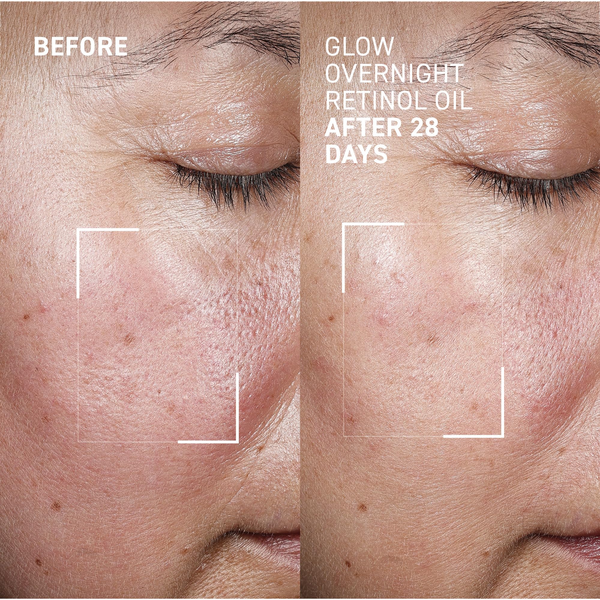 Dr. Brandt Bright This Way Glow Overnight Retinol Oil – 2 x 1 fl oz, 2% Retinol for Texture & Radiance