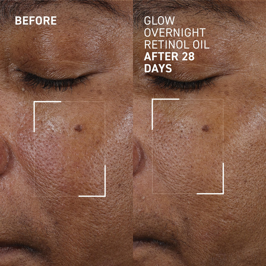 Dr. Brandt Bright This Way Glow Overnight Retinol Oil – 2 x 1 fl oz, 2% Retinol for Texture & Radiance