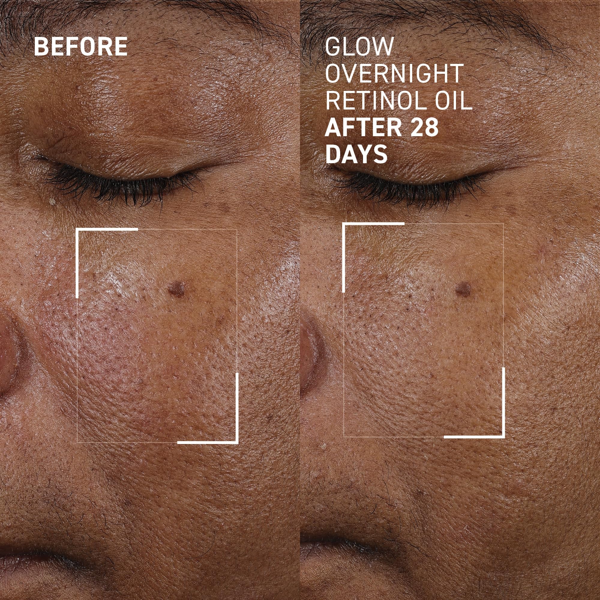 Dr. Brandt Bright This Way Glow Overnight Retinol Oil – 2 x 1 fl oz, 2% Retinol for Texture & Radiance