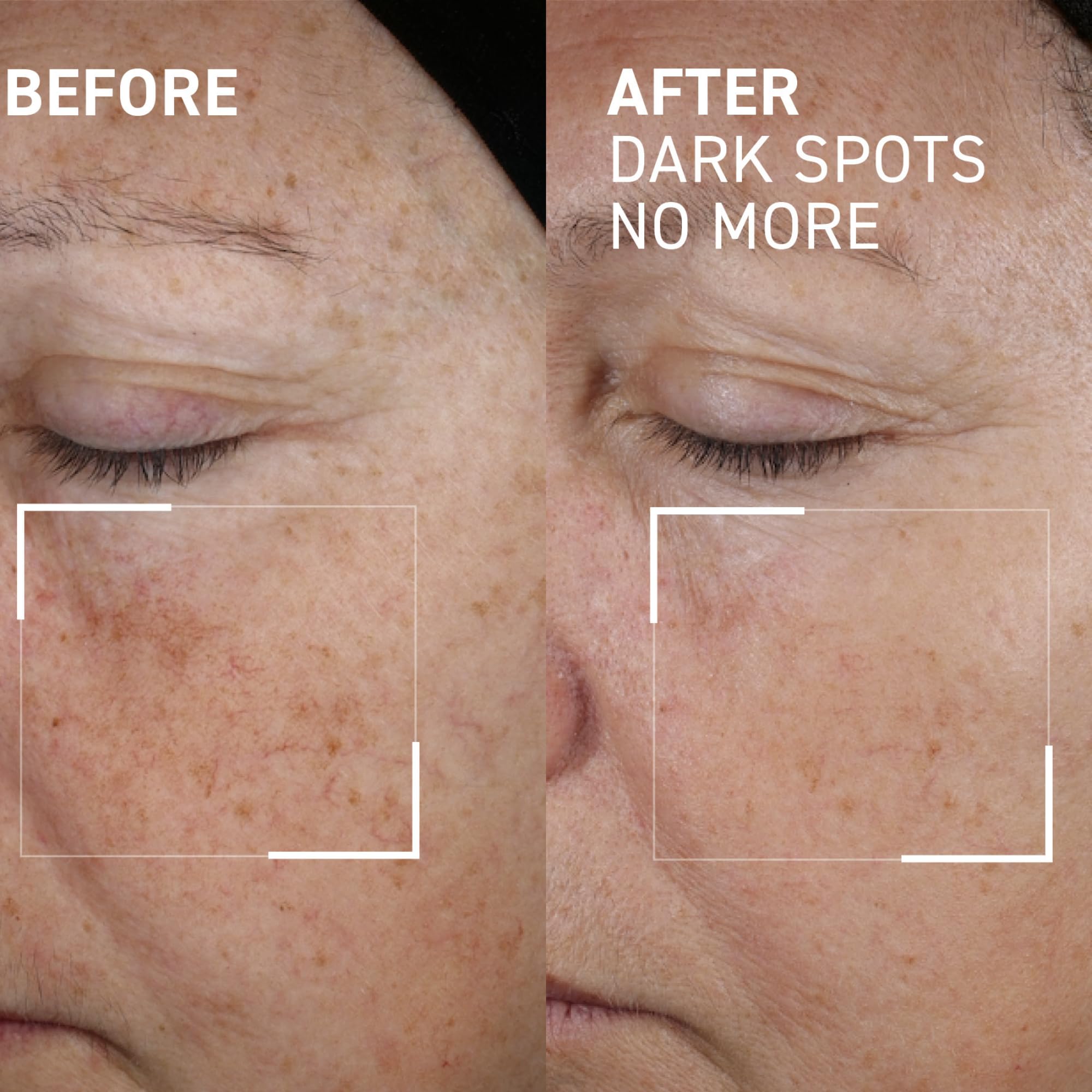 Dr. Brandt Bright This Way Dark Spots No More – 0.5 Fl Oz Pack of 2 | Target Hyperpigmentation