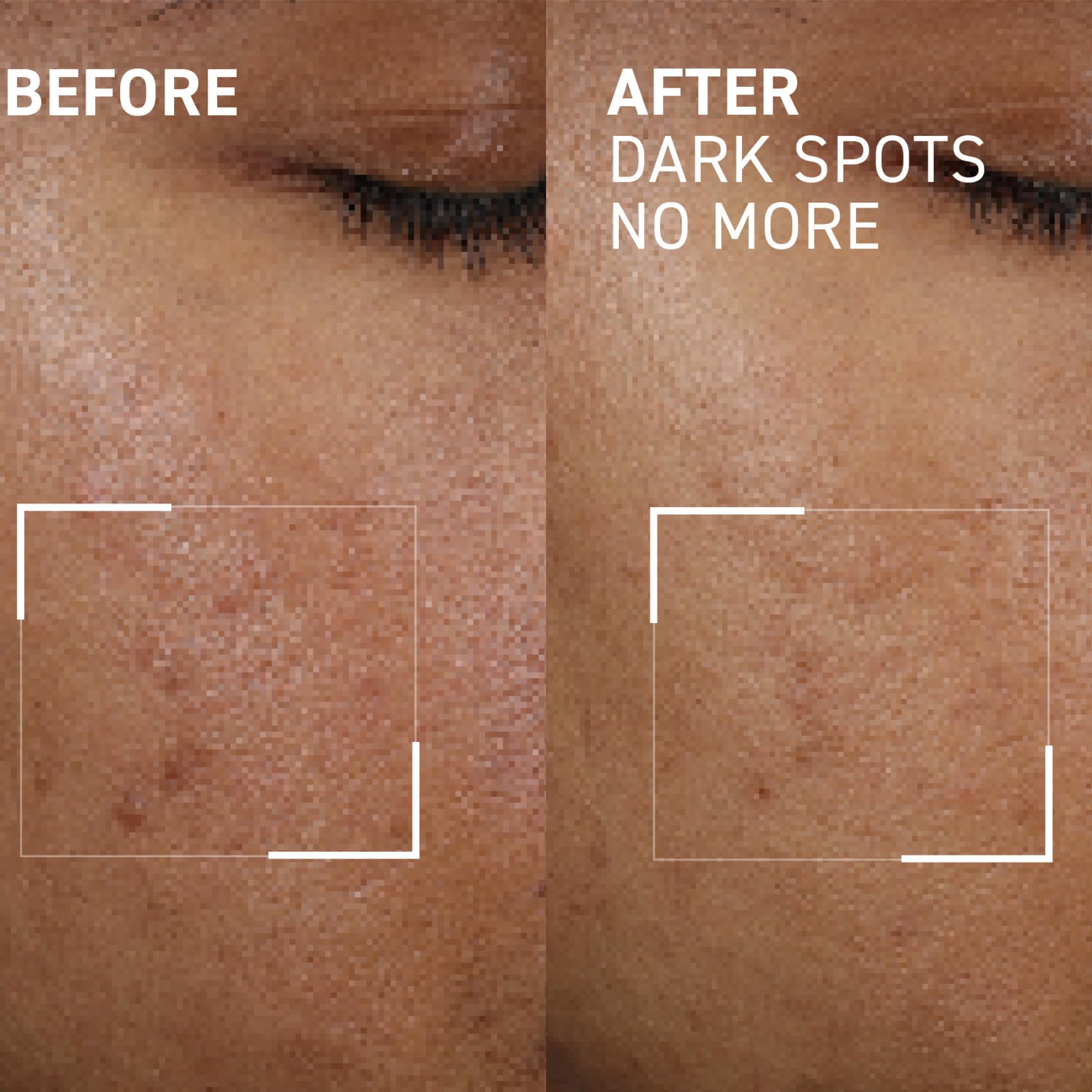 Dr. Brandt Bright This Way Dark Spots No More – 0.5 Fl Oz Pack of 2 | Target Hyperpigmentation