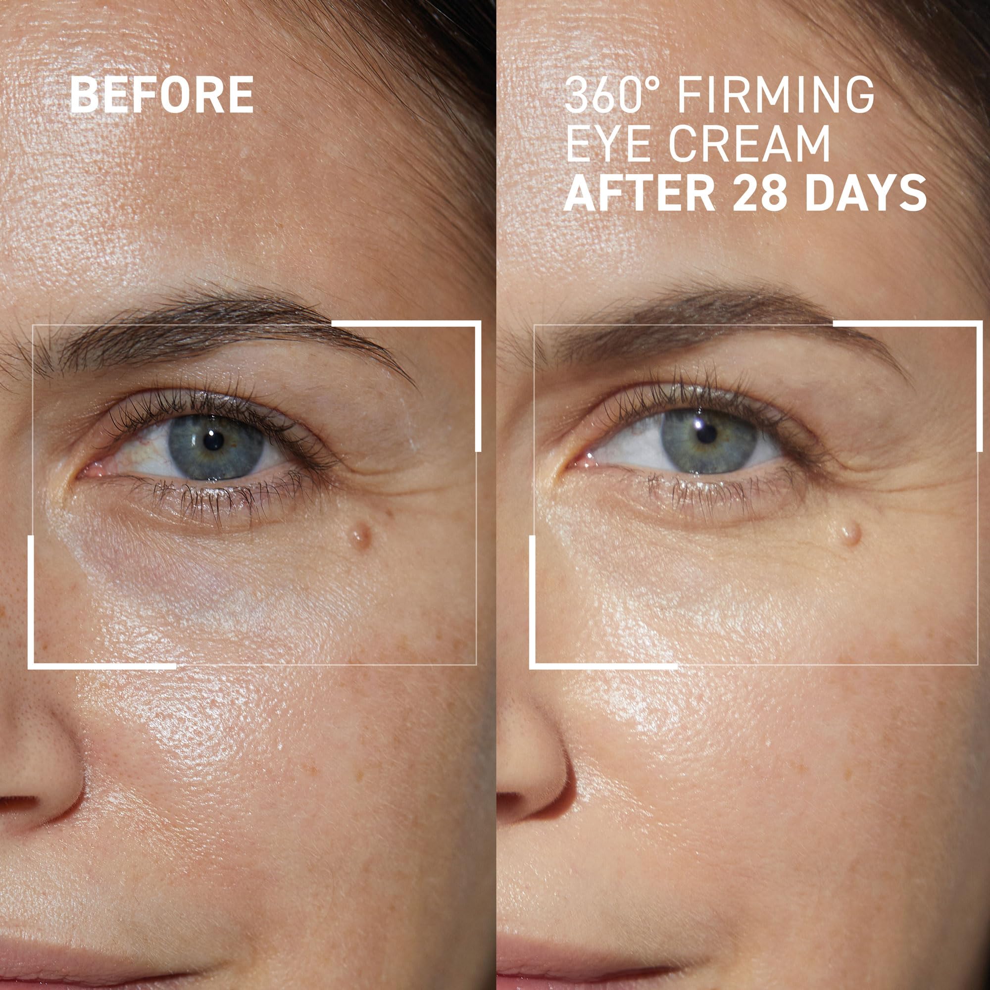Dr. Brandt Dare to Age 360° Firming Eye Cream – 0.5 oz (Pack of 2) | Targets Fine Lines, Dark Circles & Sagging Skin