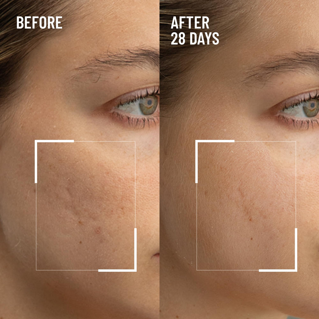Dr. Brandt Microdermabrasion Renewing Face Exfoliator – 2-Pack, Smooth Texture