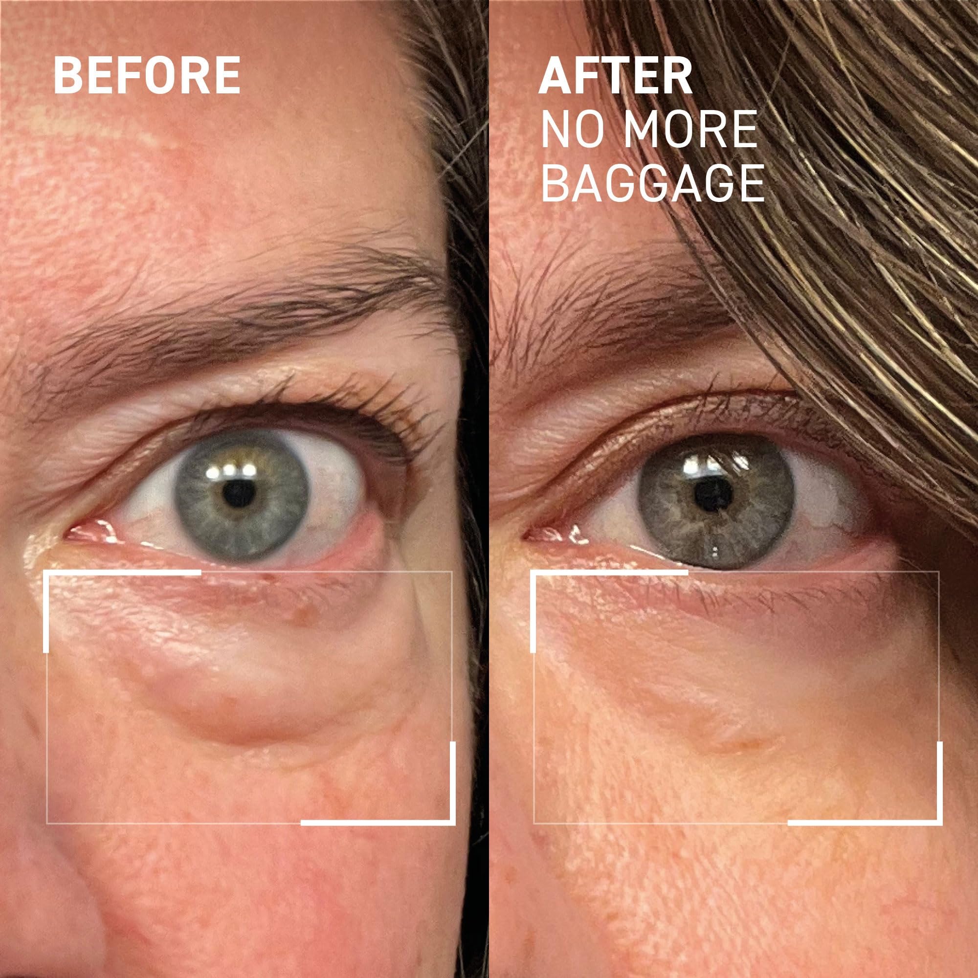 Dr. Brandt Needles No More Baggage – Jumbo 1 oz Eye De-Puffing Gel