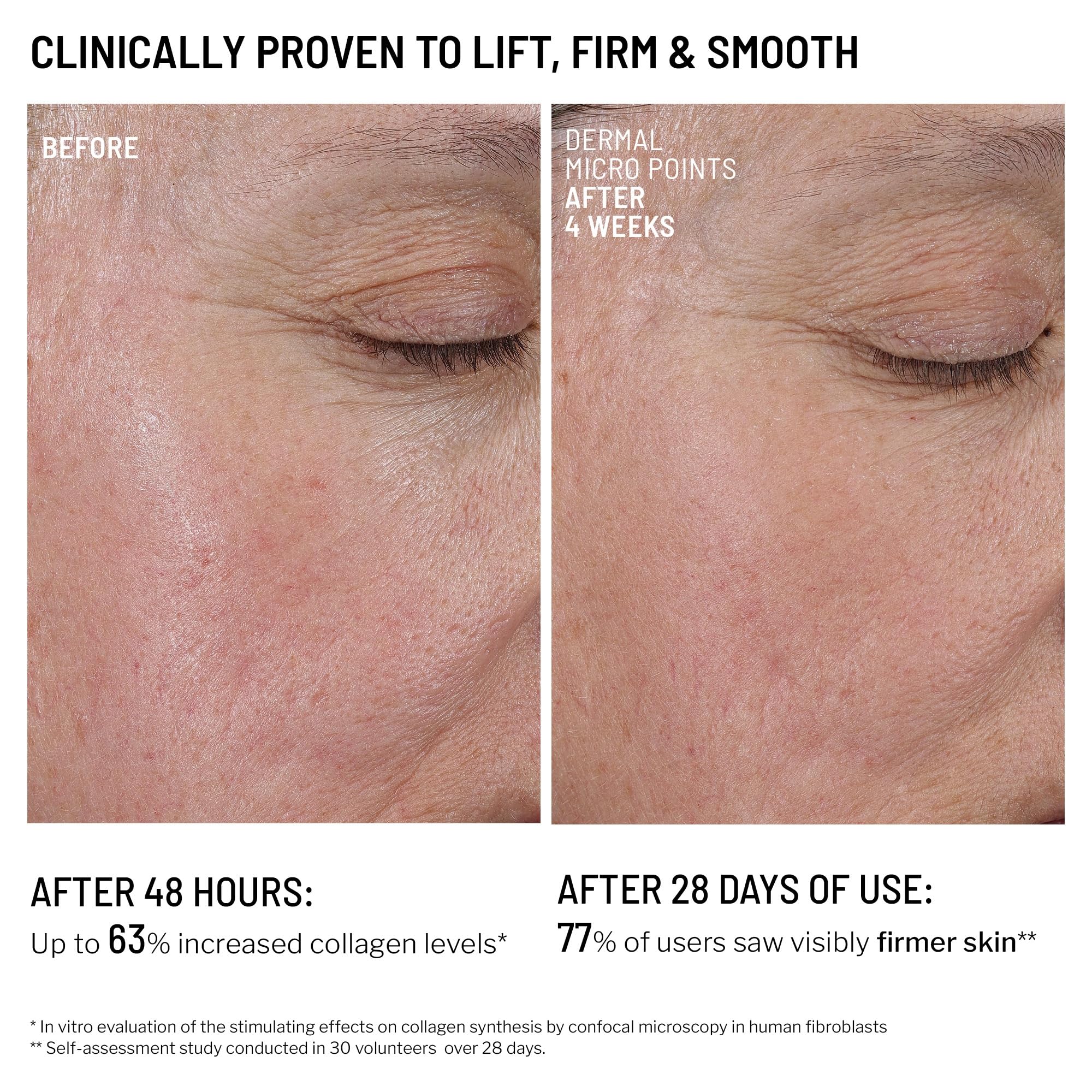 Dr. Brandt Needles No More Dermal Micro Points – Intensive Skin-Lifting Gel for Texture & Fine Lines | 1.0 oz