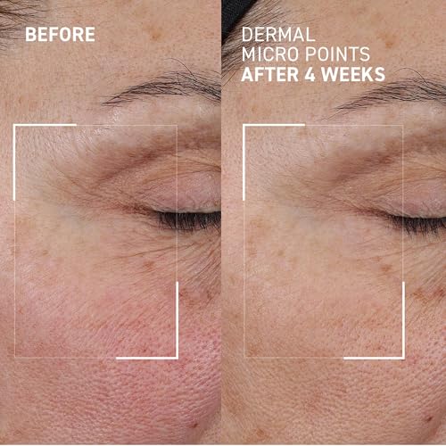 Dr. Brandt Needles No More Dermal Micro Points – Intensive Skin-Lifting Gel for Texture & Fine Lines | 1.0 oz