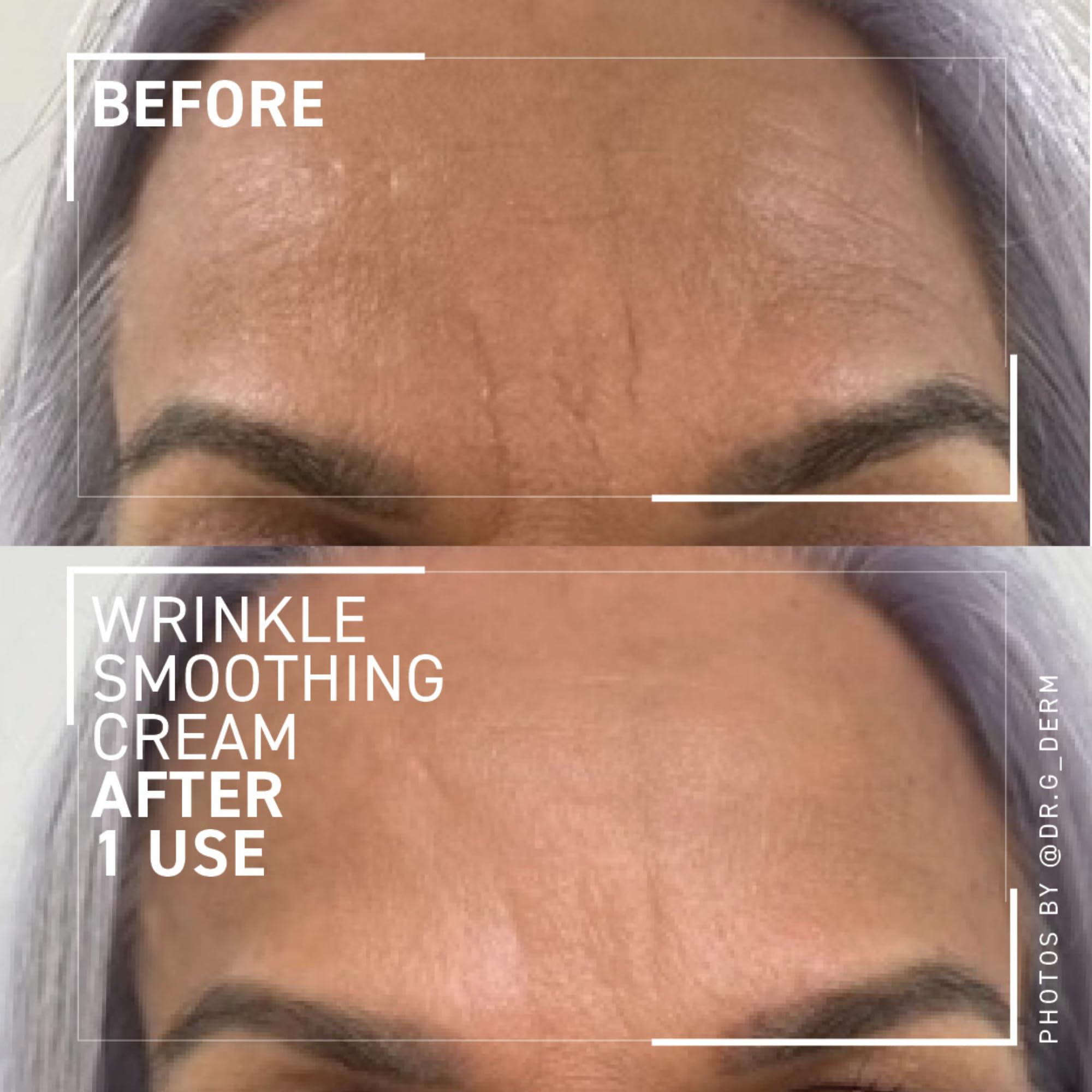 Dr. Brandt Needles No More Wrinkle Smoothing Cream – Smooths Lines & Firms Skin (0.5 oz, Pack of 2)