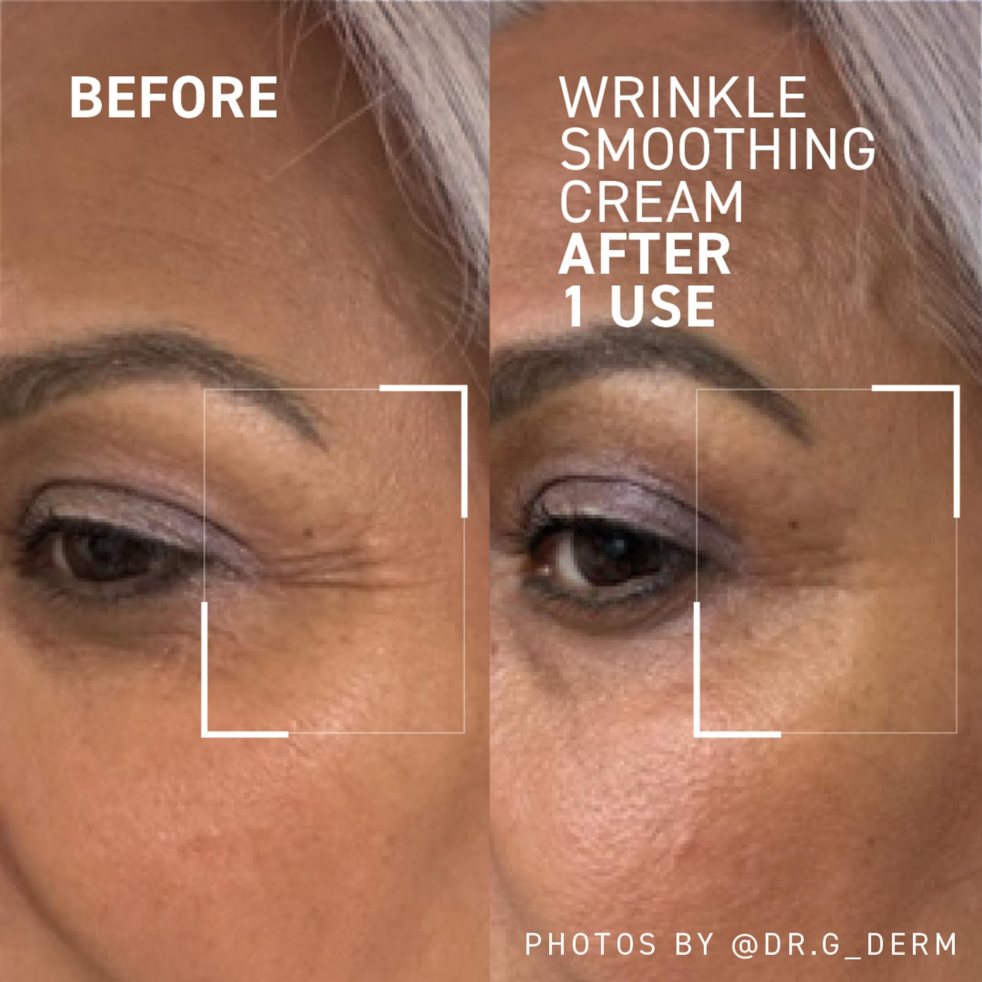 Dr. Brandt Needles No More Wrinkle Smoothing Cream – Smooths Lines & Firms Skin (0.5 oz, Pack of 2)