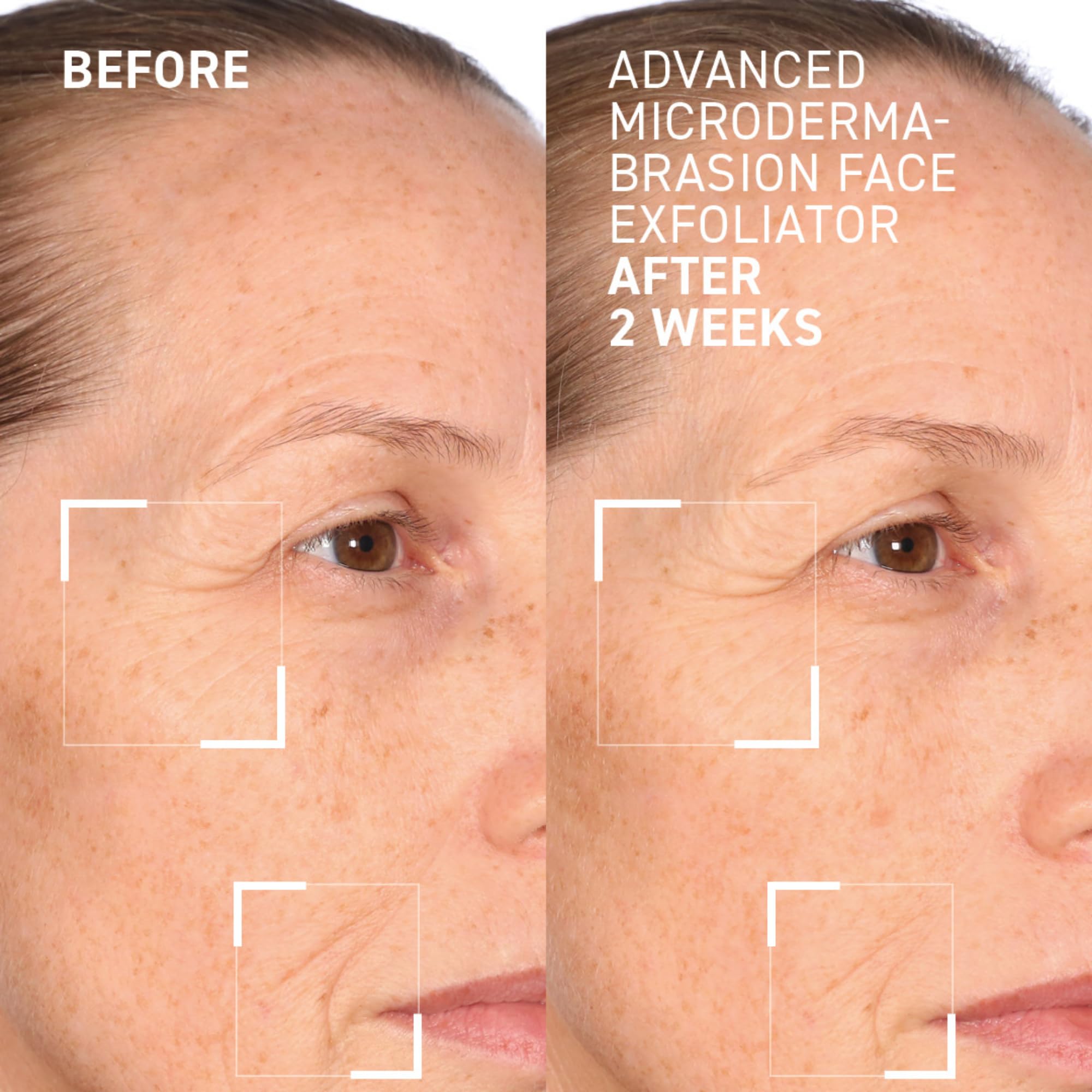 Dr. Brandt Advanced Microdermabrasion Face Exfoliator – Refines Texture & Evens Skin Tone | 2 oz
